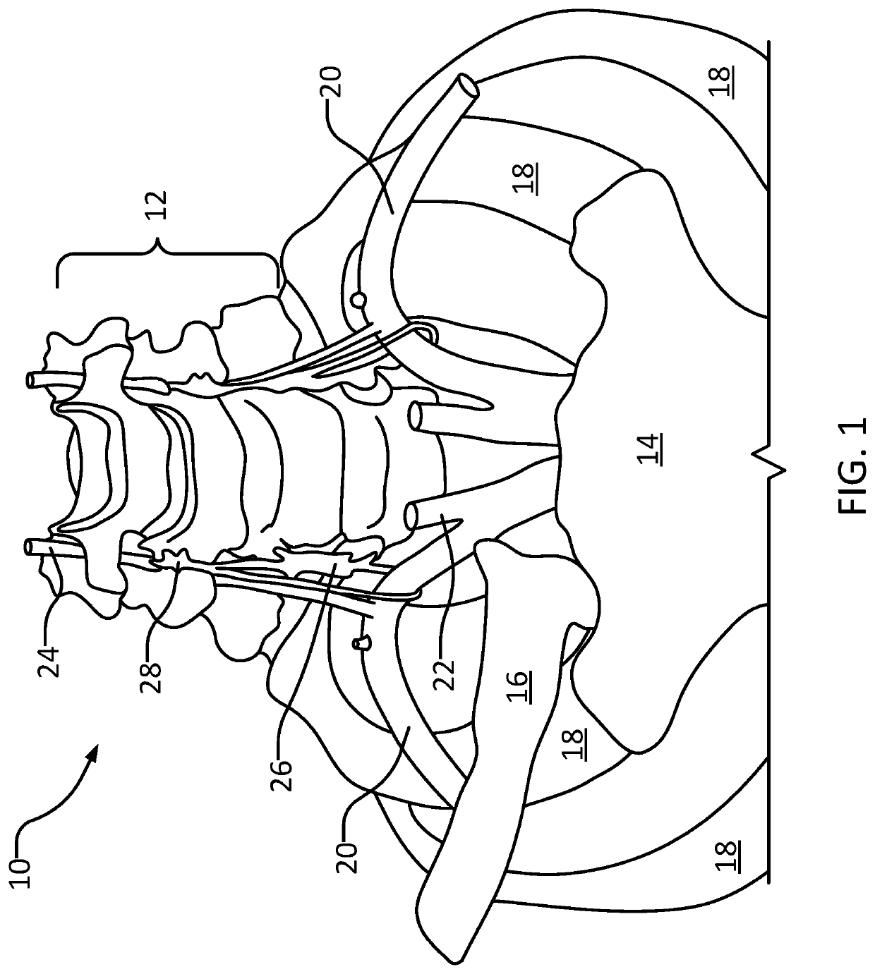 Systems and methods for stellate ganglion simulation and ablation