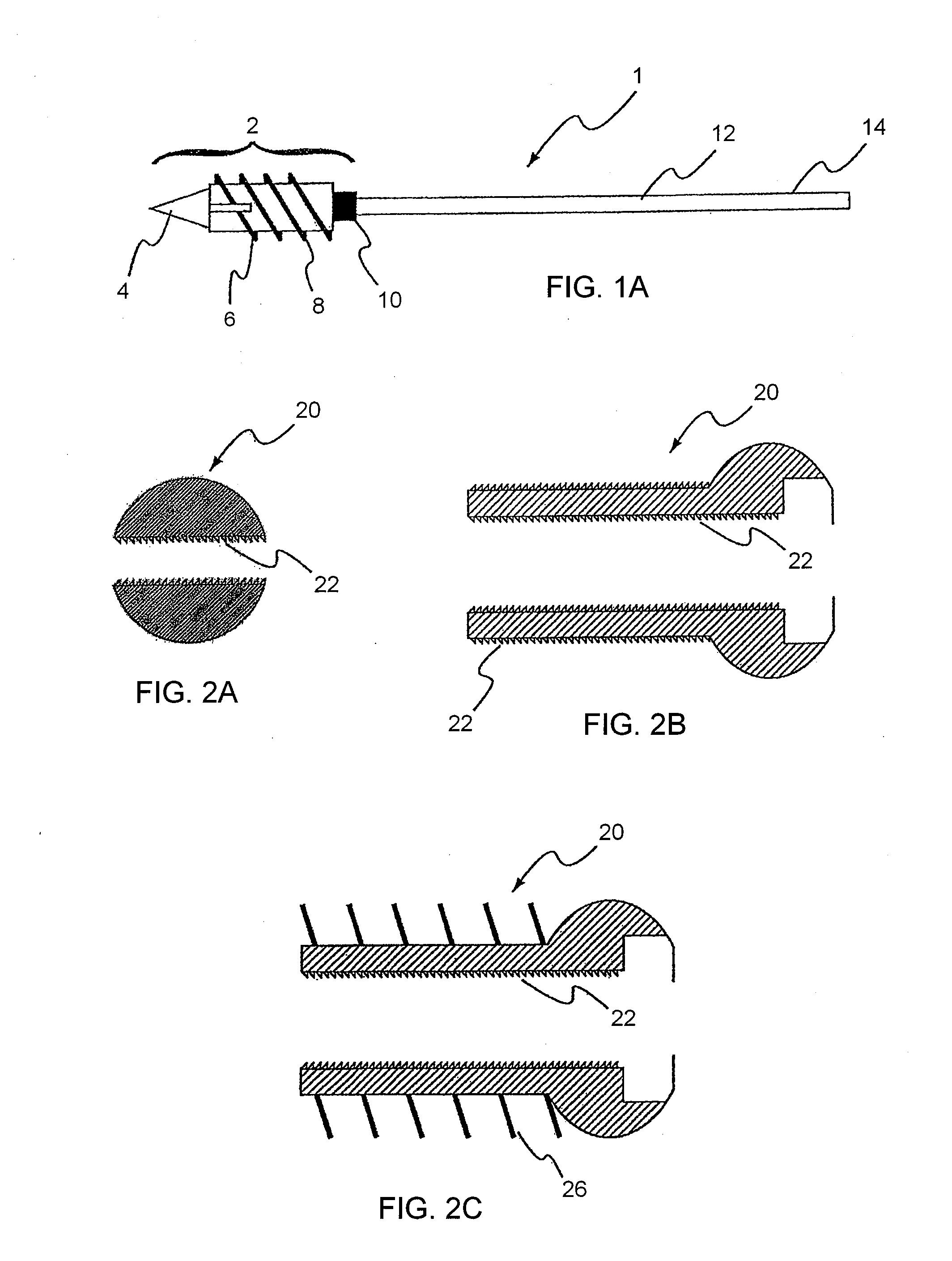 Guide system and method for the fixation of bone fractures