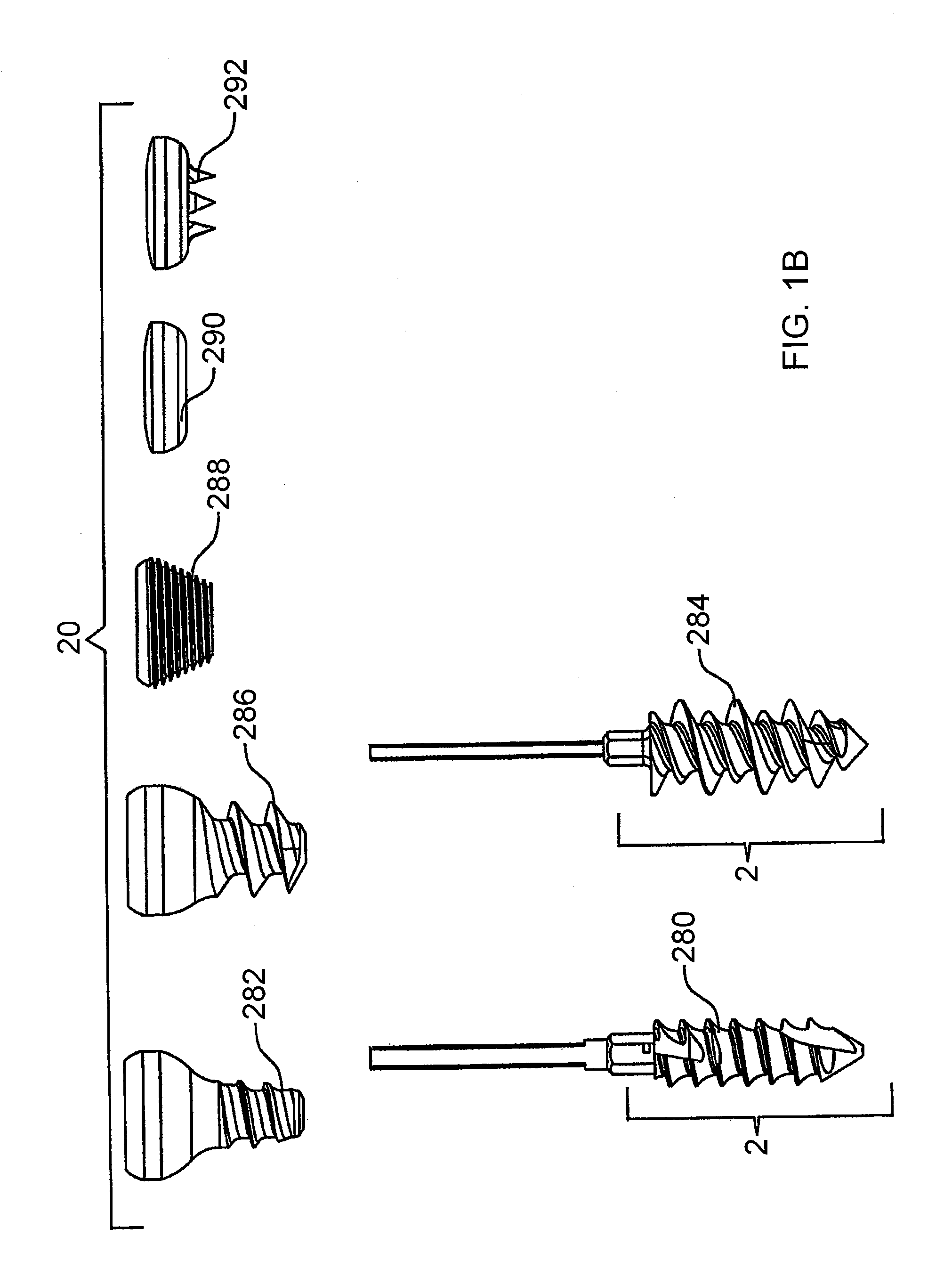 Guide system and method for the fixation of bone fractures