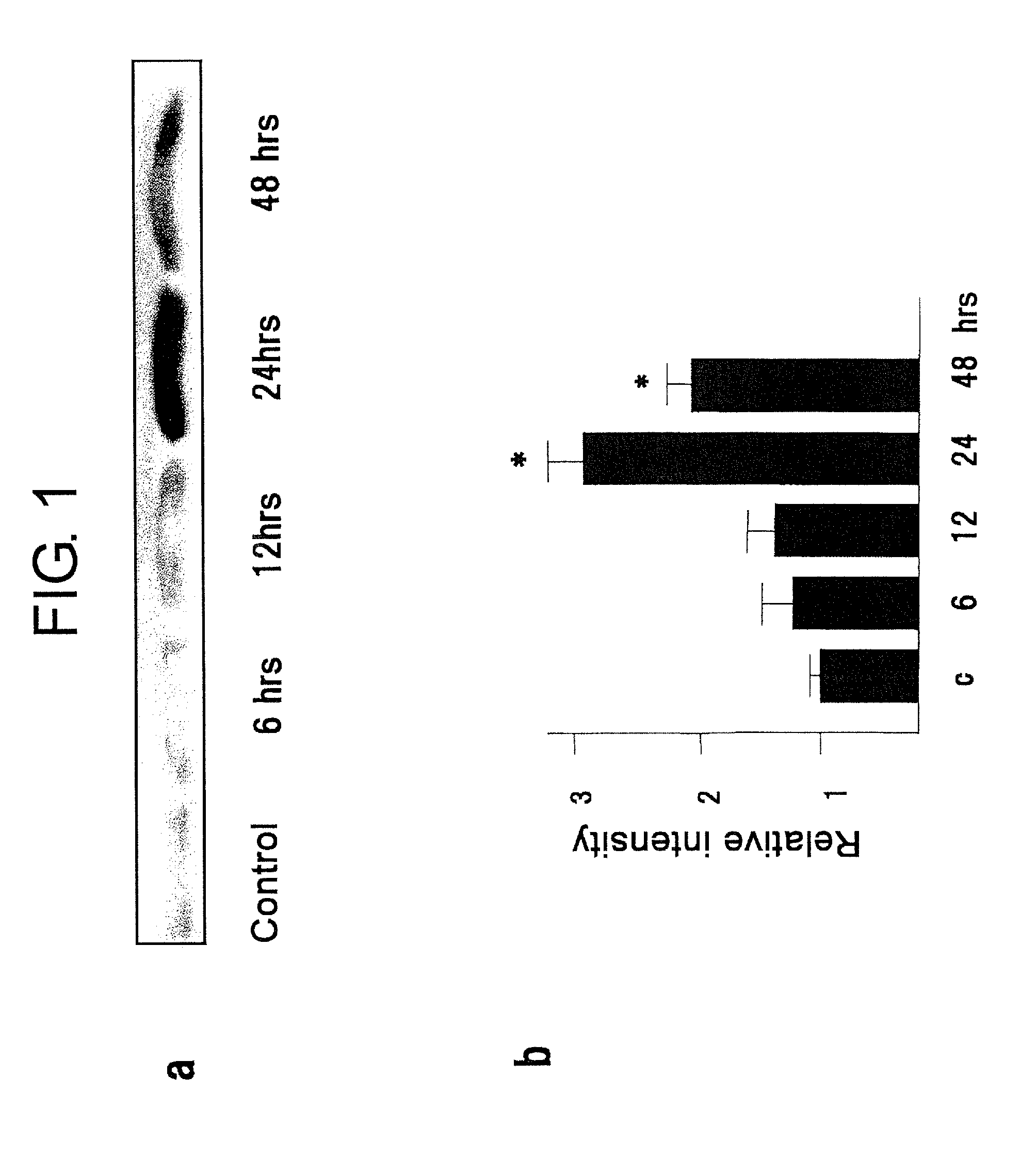 Method to reduce loss of cardiac function following ischemia/reperfusion