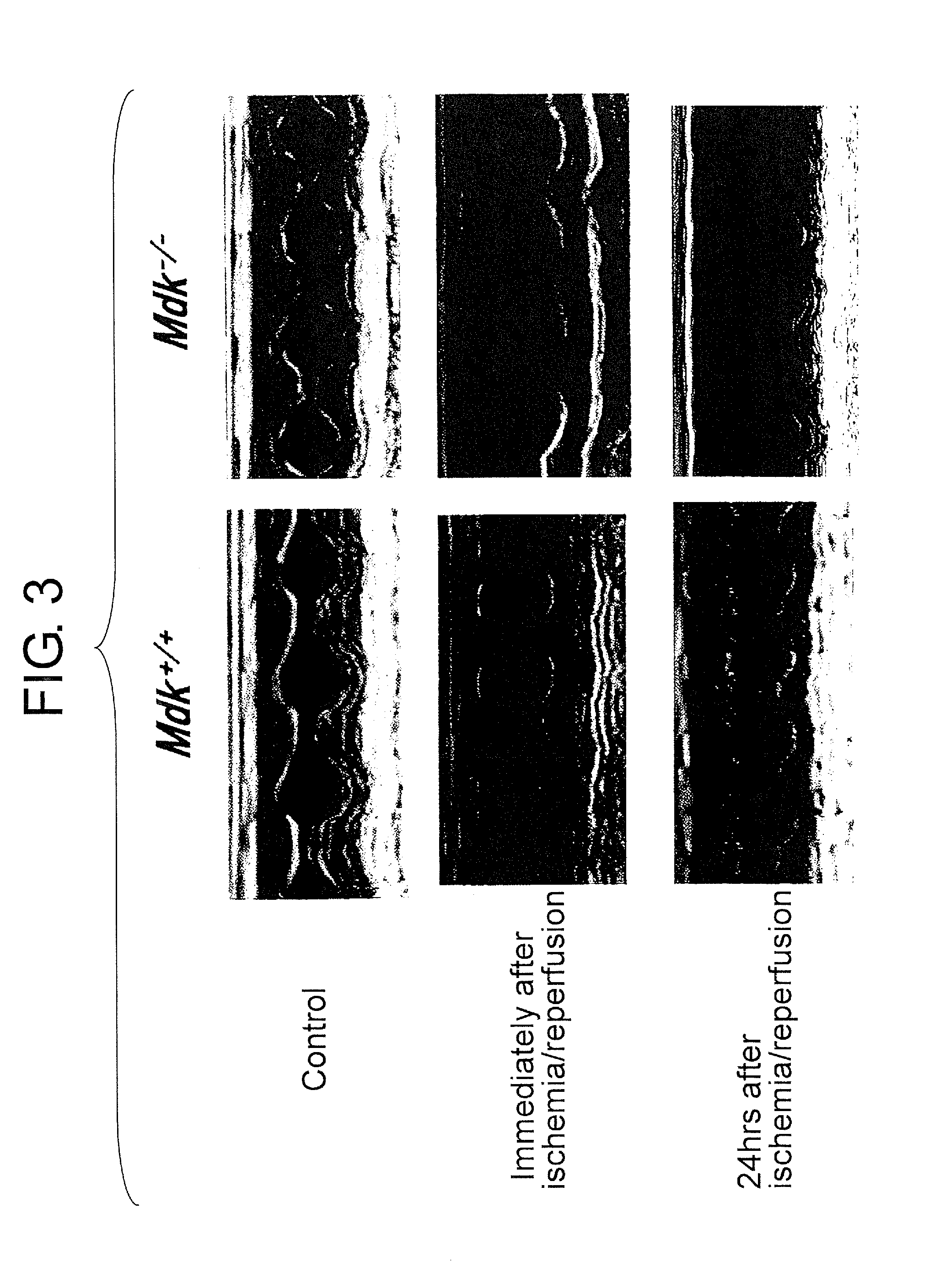 Method to reduce loss of cardiac function following ischemia/reperfusion