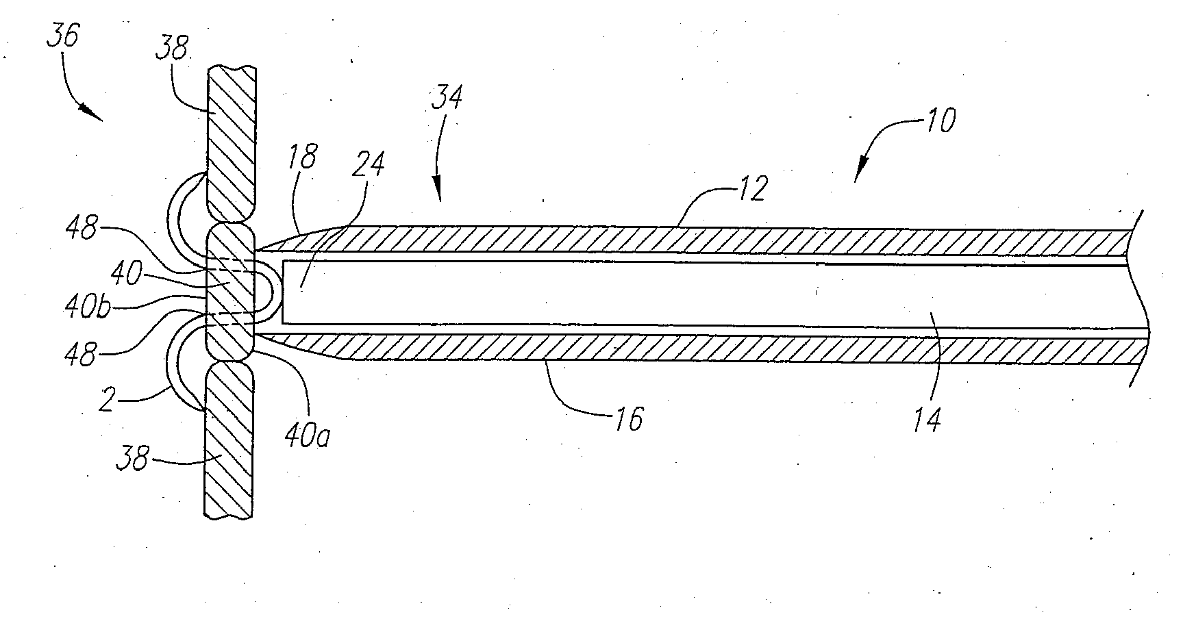 Clip Apparatus For Closing Septal Defects And Methods Of Use