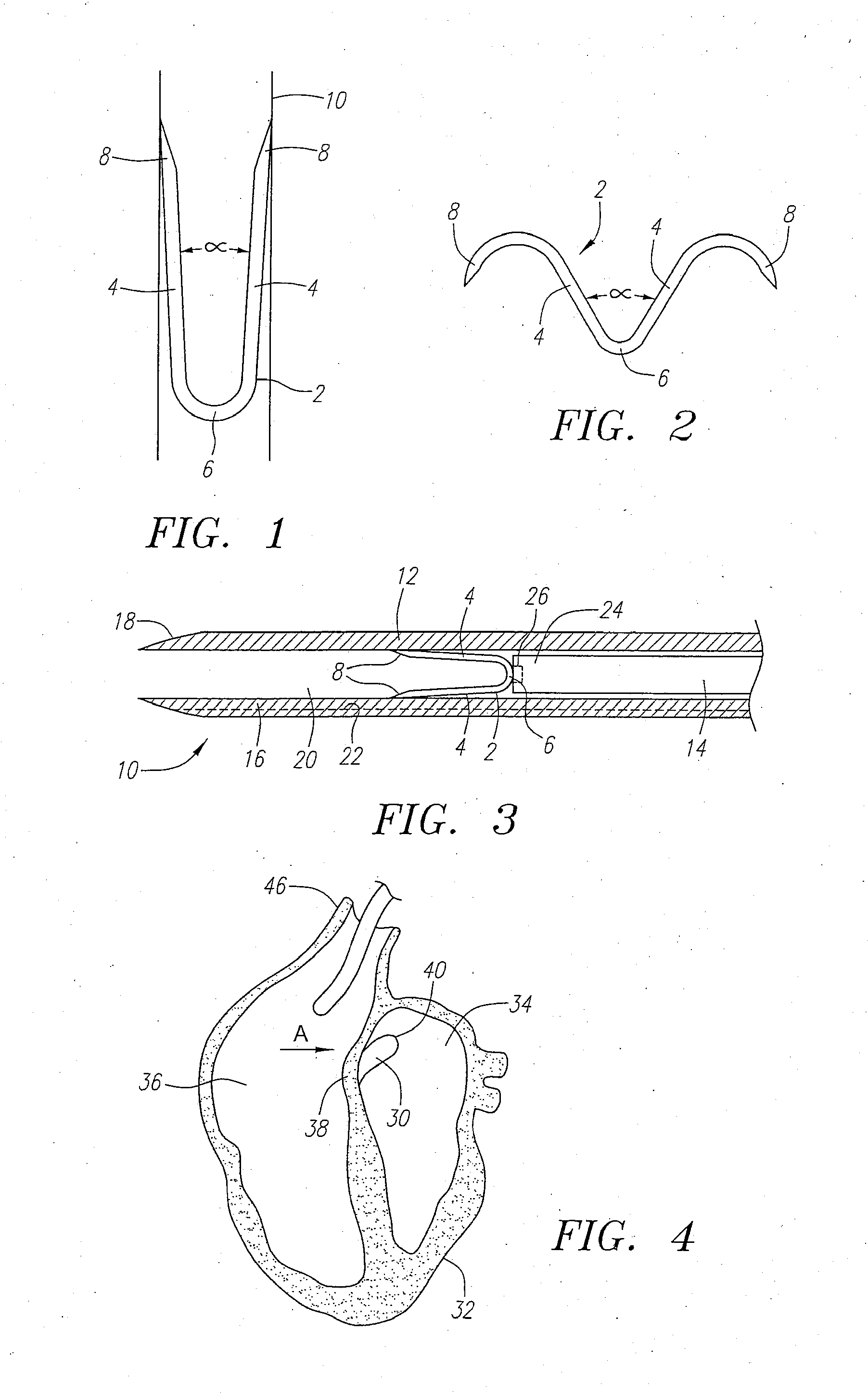 Clip Apparatus For Closing Septal Defects And Methods Of Use