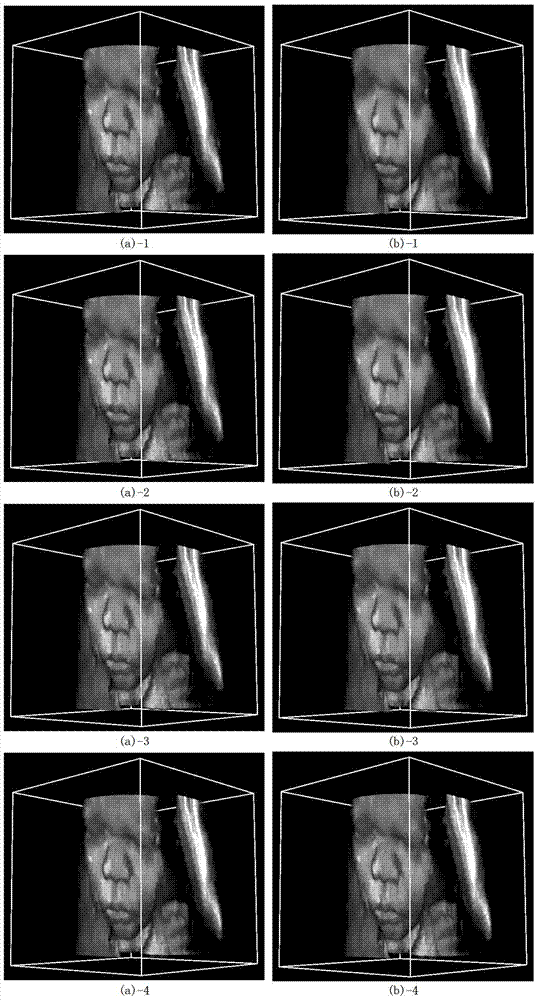 Non-local mean filter method for three-dimensional ultrasonic images