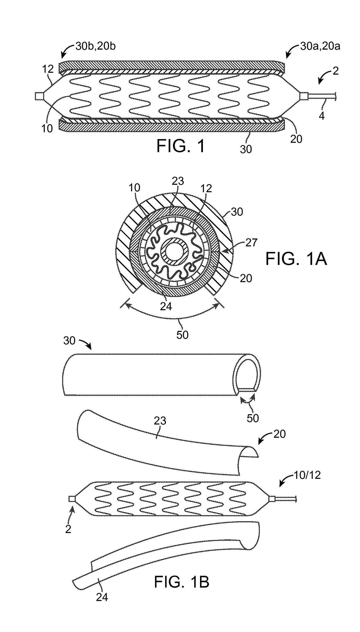 Clip sheath for a polymer scaffold