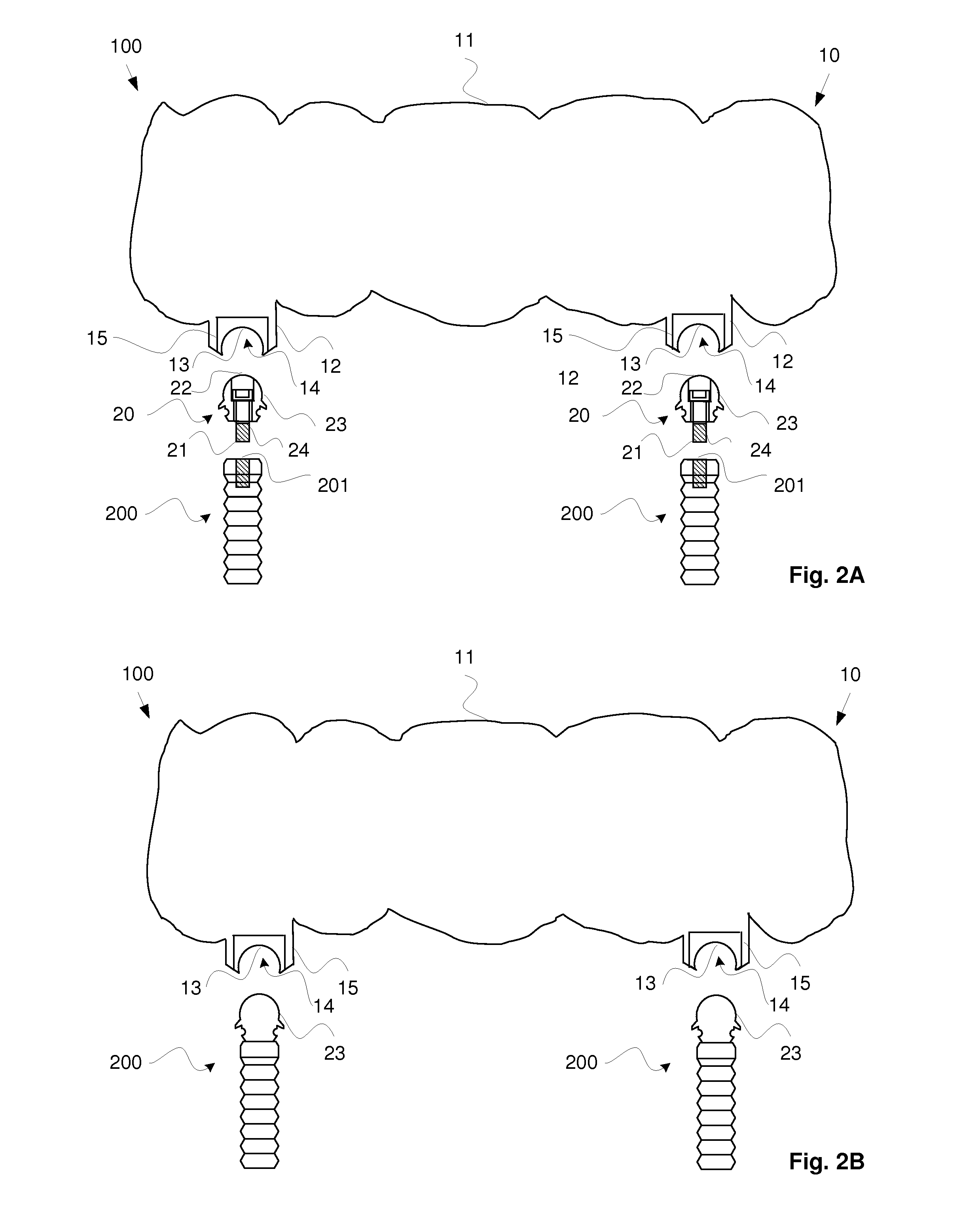 Superstructure and methods for manufacturing the same