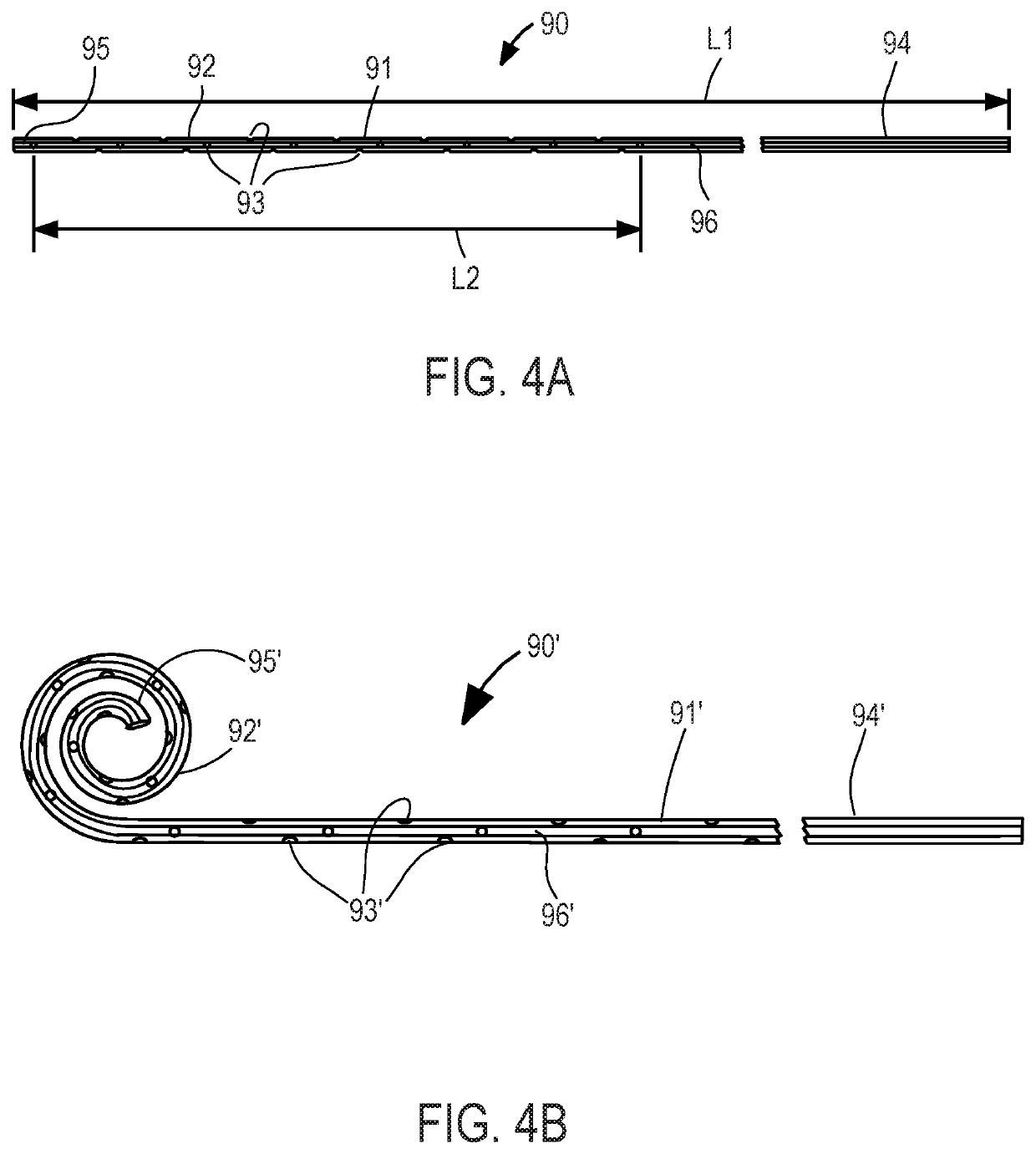 Implantable fluid management system having clog resistant catheters, and methods of using same