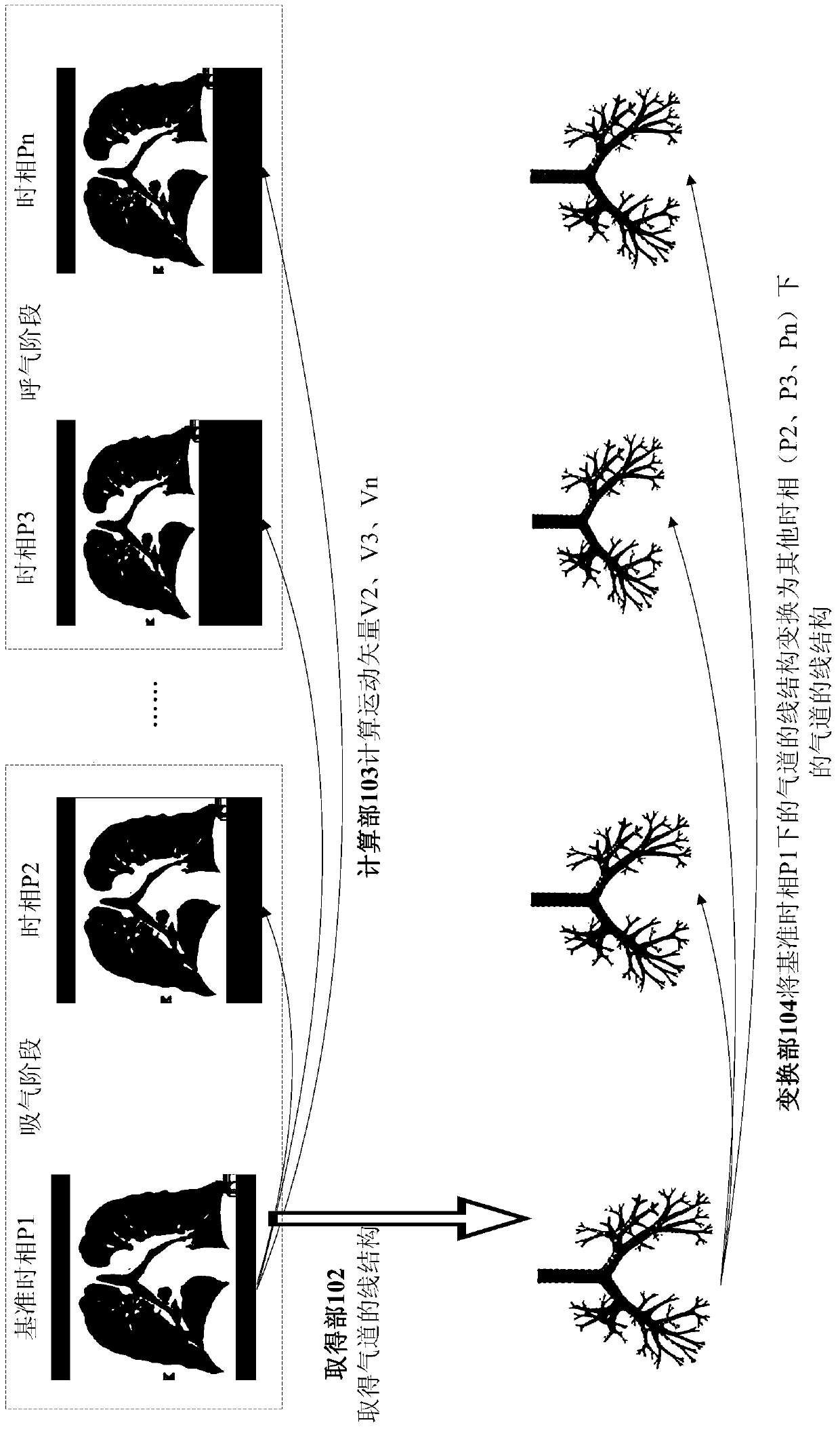 Medical image processing device and medical image processing method