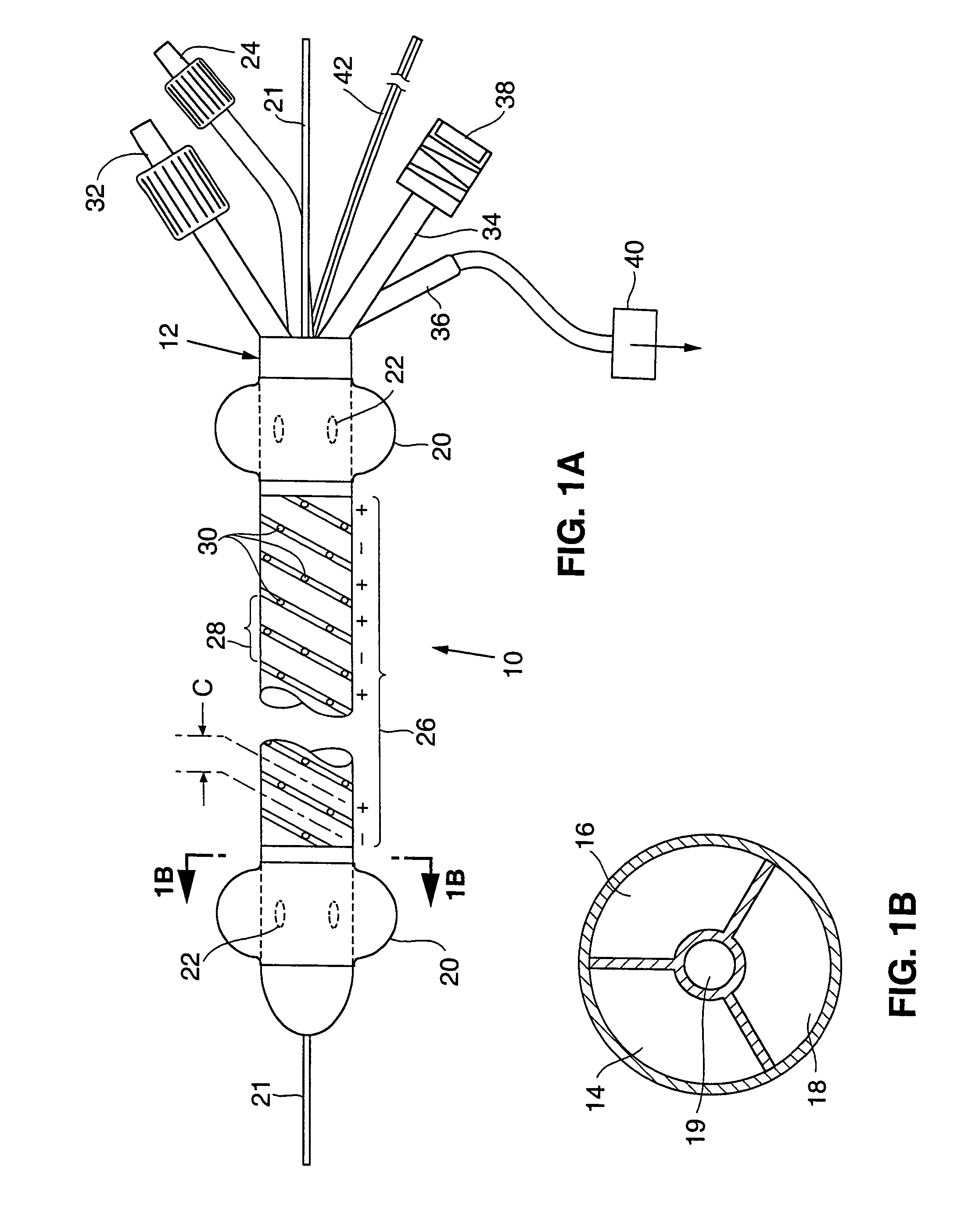 Apparatus and method for treating venous reflux