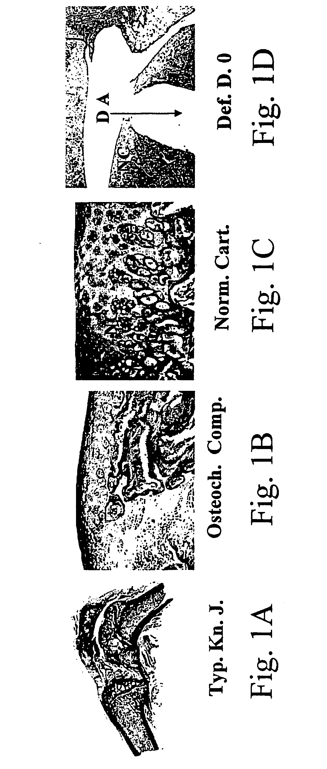 Compositions comprising bone marrow cells together with demineralized and/or mineralized bone matrix and uses thereof in the induction of bone and cartilage formation