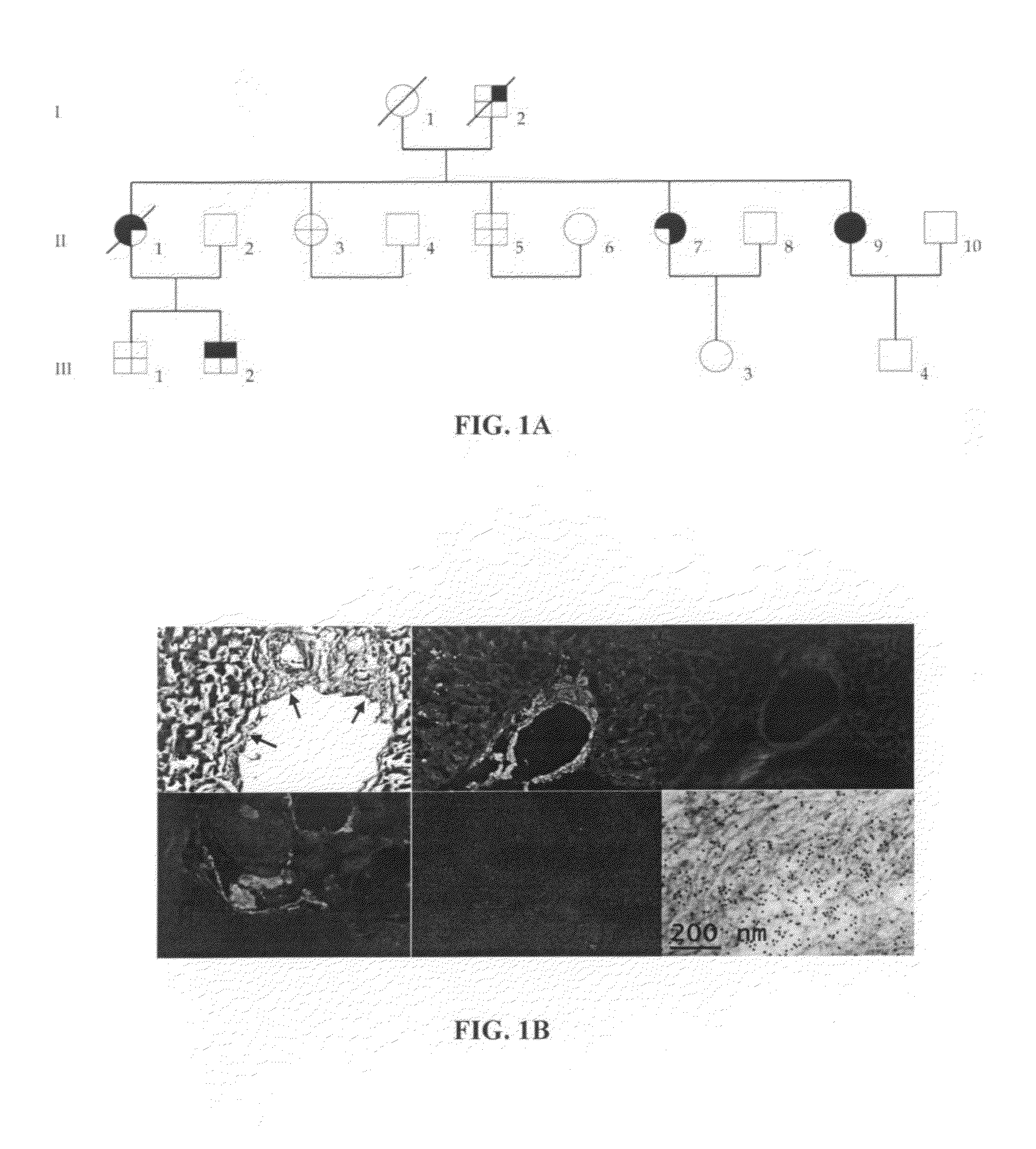 Variant Beta2-microglobulin, characterization of the same and applications thereof