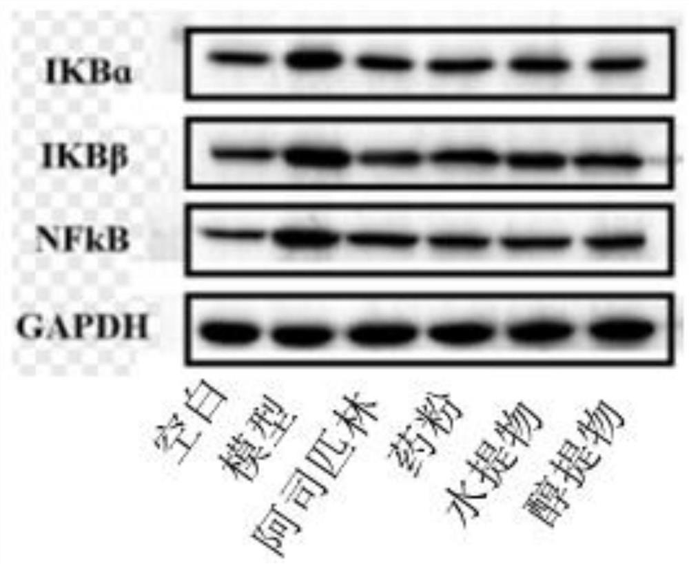 Application of saussurea japonica in preparation of medicine for preventing and treating diseases characterized by fever caused by microbial infection