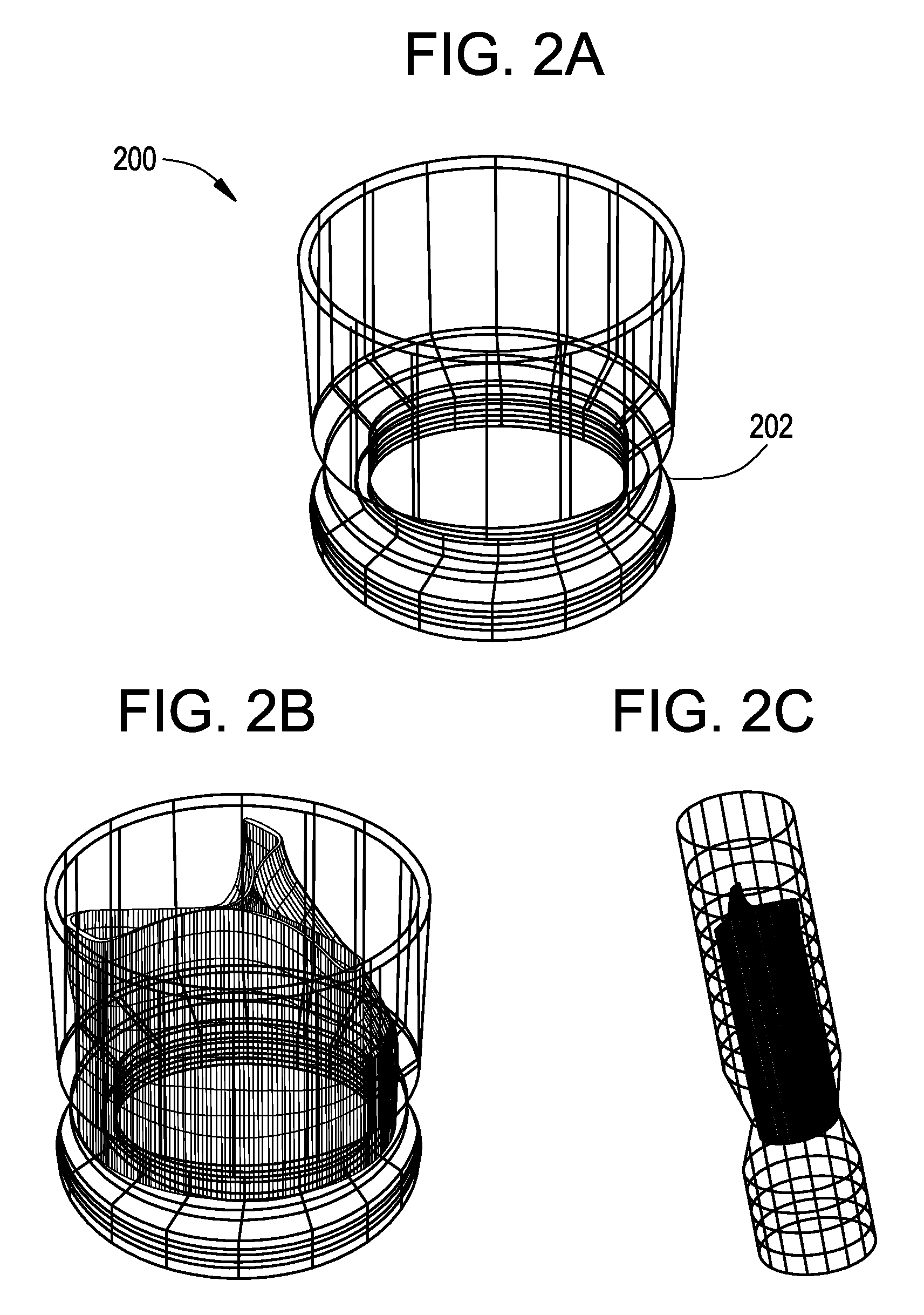 Stent-valves for valve replacement and associated methods and systems for surgery