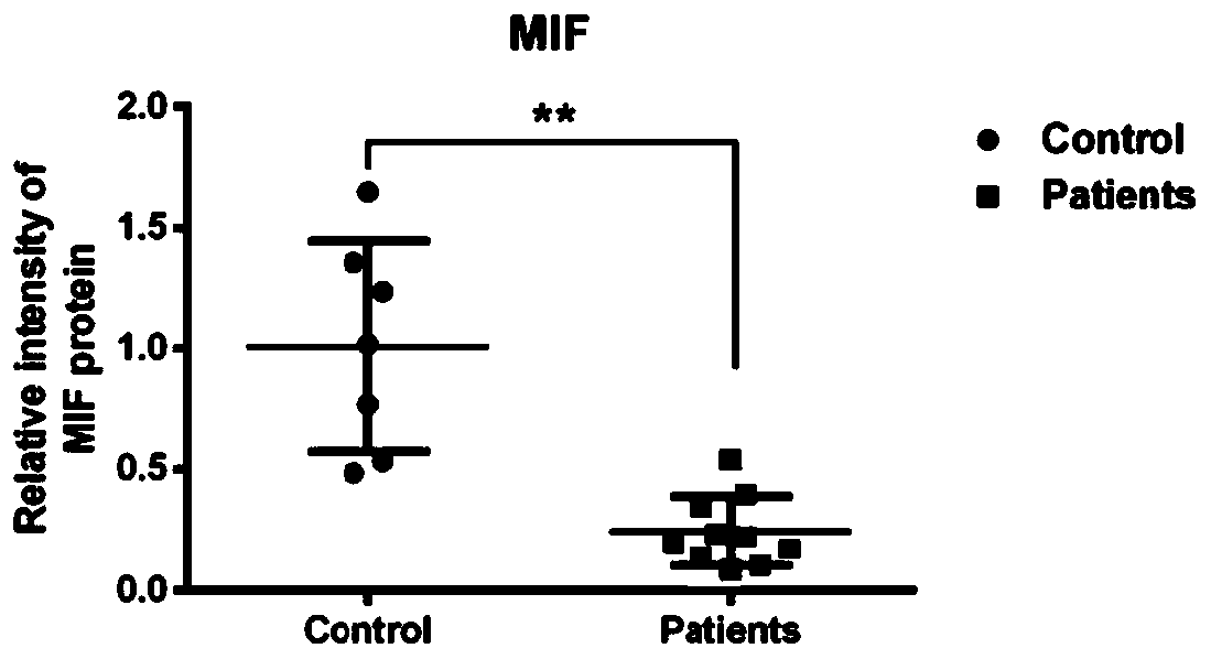 Application of miR-146a in preparation of products for diagnosing steroid-induced femoral head necrosis