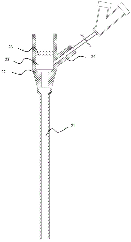 Arterial remaining needle capable of displaying arterial pulsation
