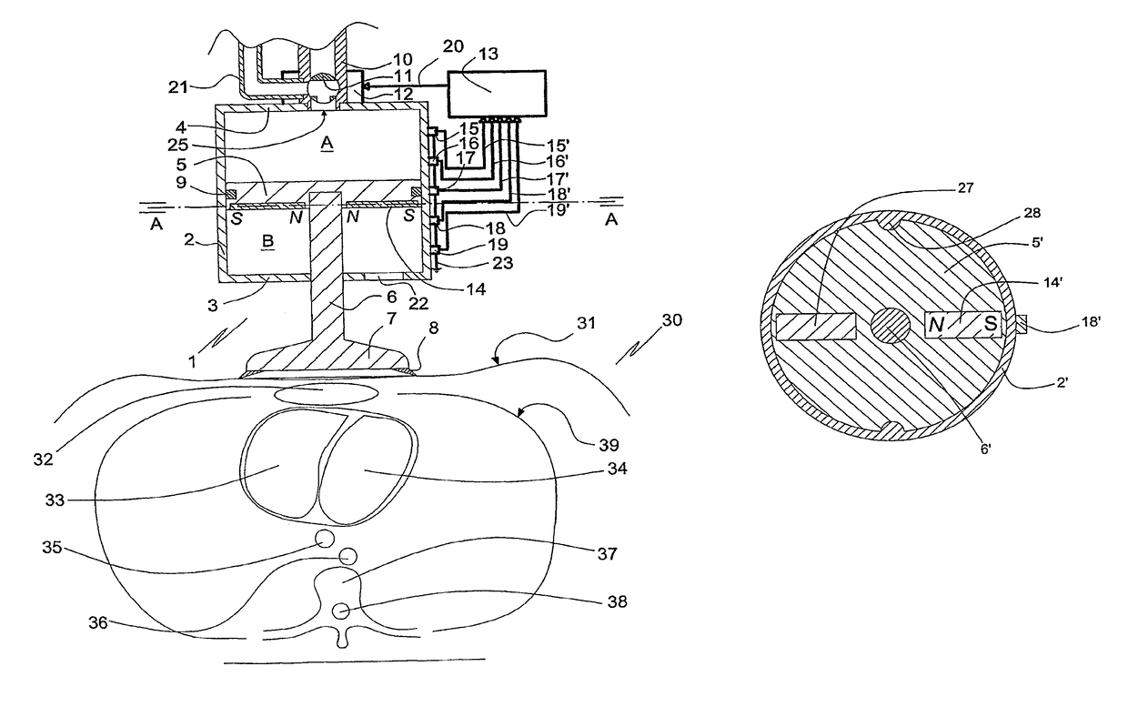 Driving control of a reciprocating CPR apparatus