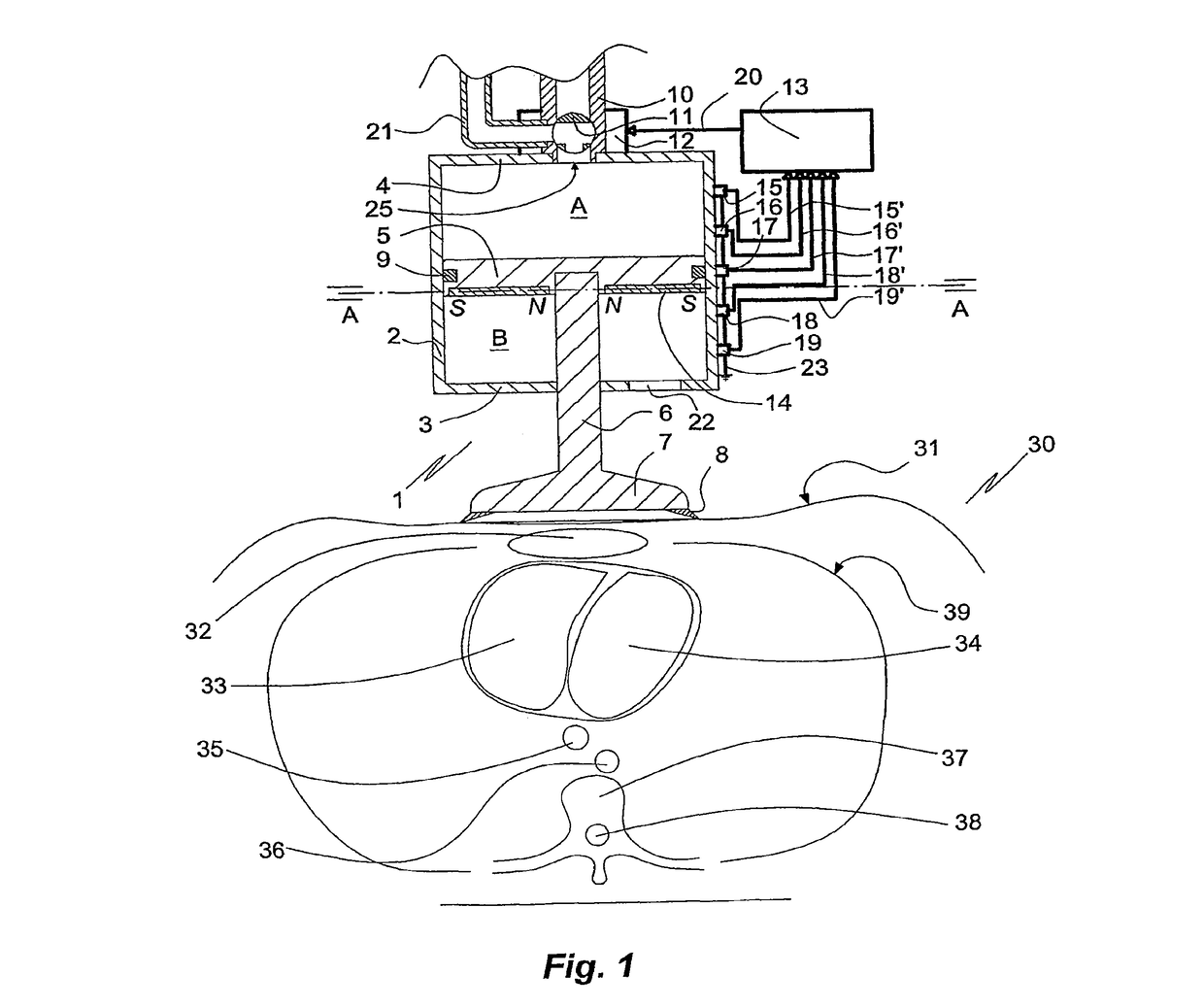 Driving control of a reciprocating CPR apparatus