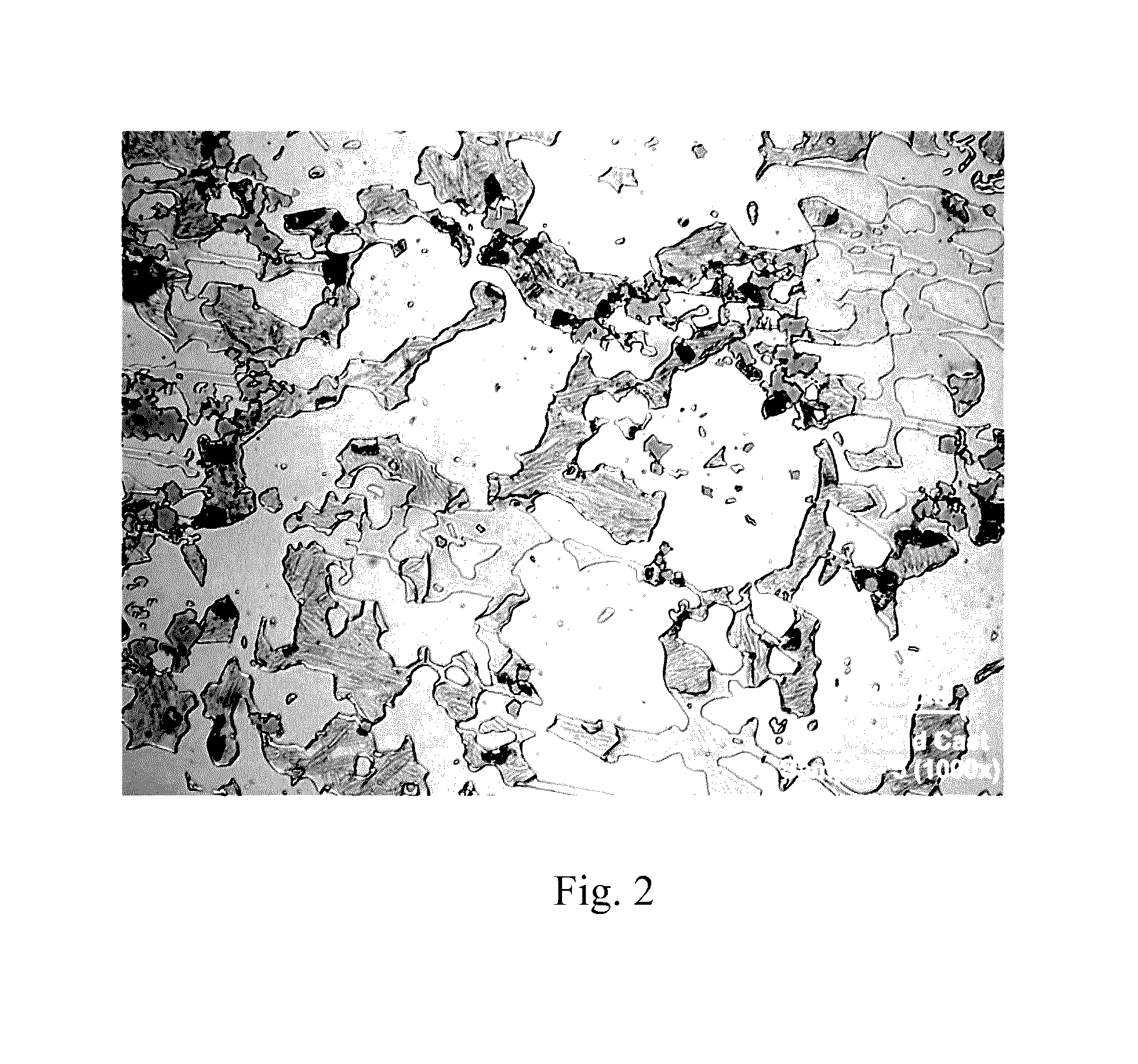 Hypereutectic white iron alloys comprising chromium, boron and nitrogen and articles made therefrom