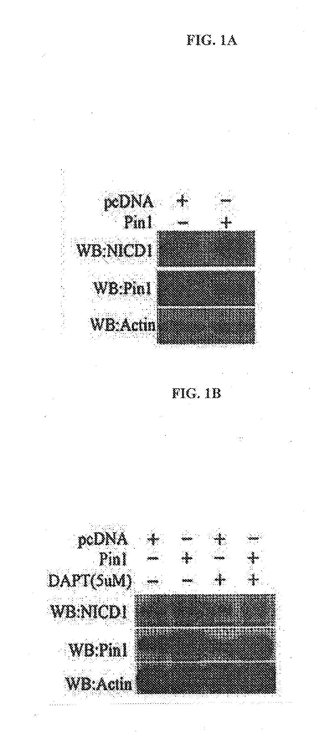 Composition for the prevention or treatment of the symptoms in the stroke comprising the inhibitor of Pin1