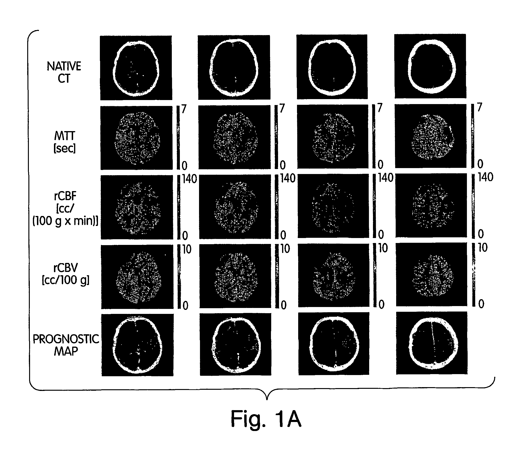 Method and apparatus for creating penumbra and infarct images