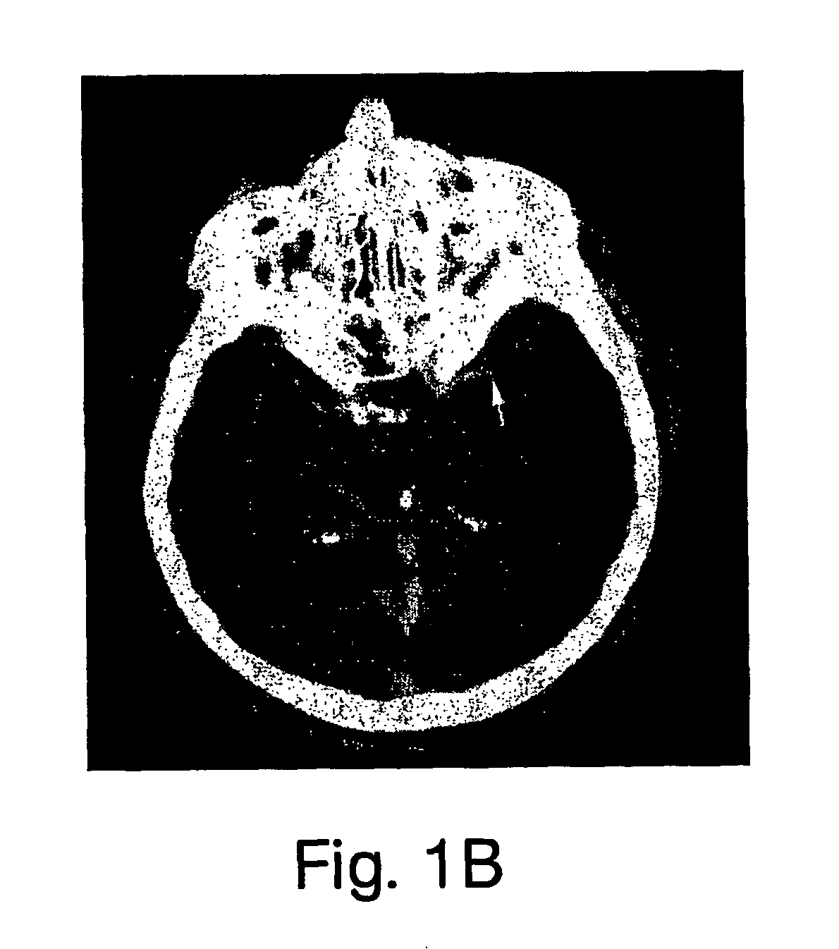 Method and apparatus for creating penumbra and infarct images