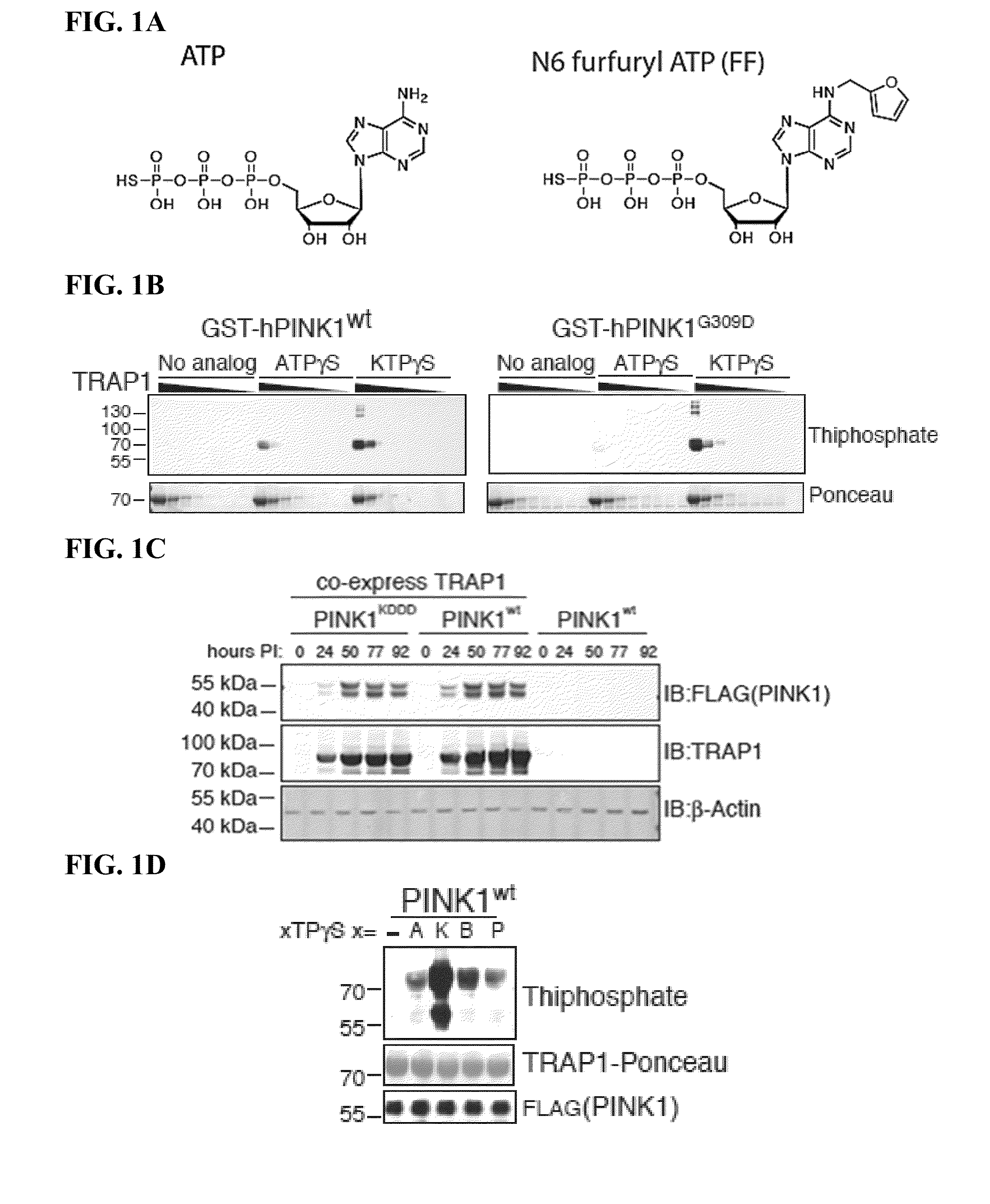 Compositions and methods for treating neurodegenerative diseases and cardiomyopathy