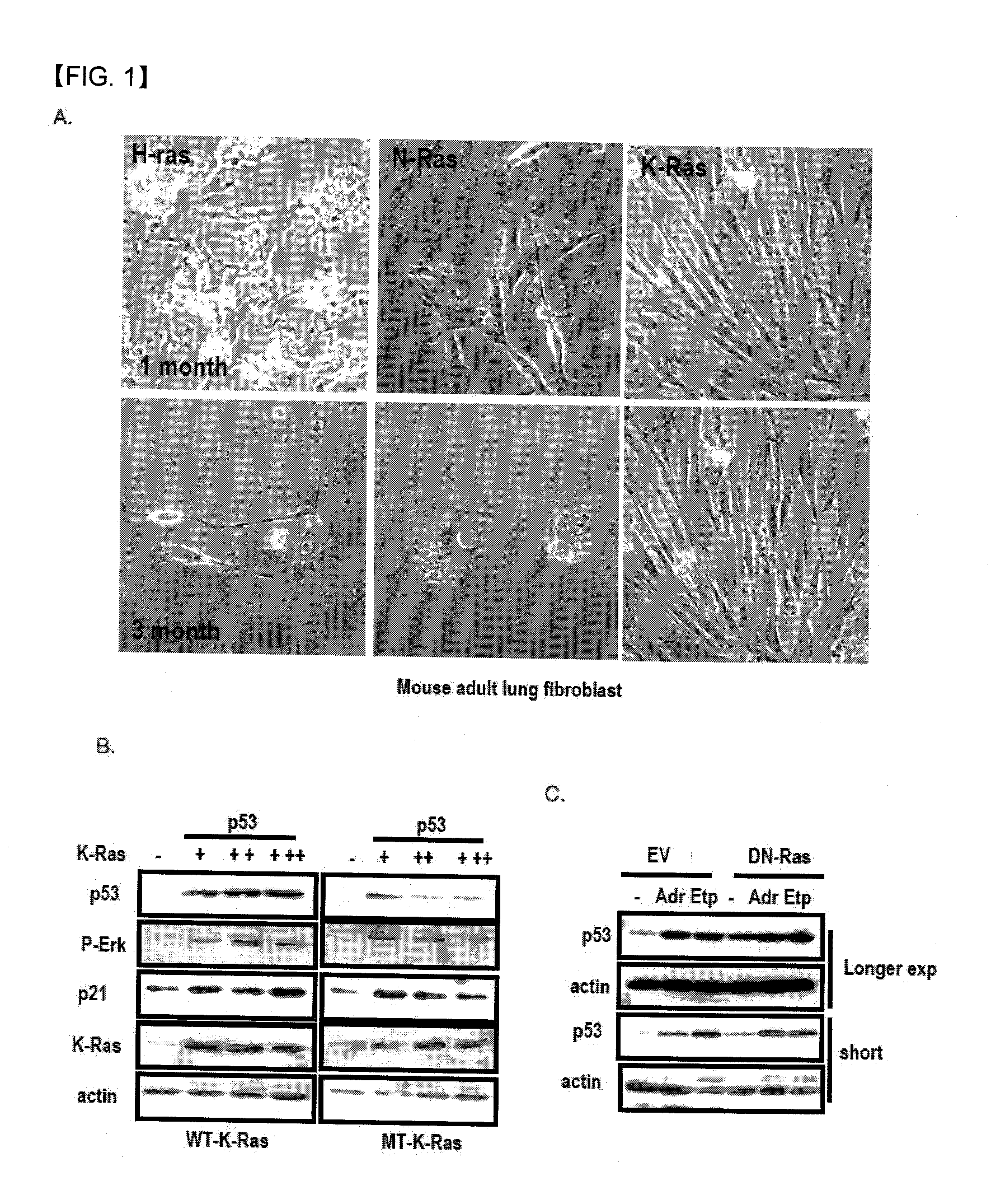Chemical inhibitor of p53-snail binding and pharmaceutical composition for treating cancer disease containing same as its active ingredient