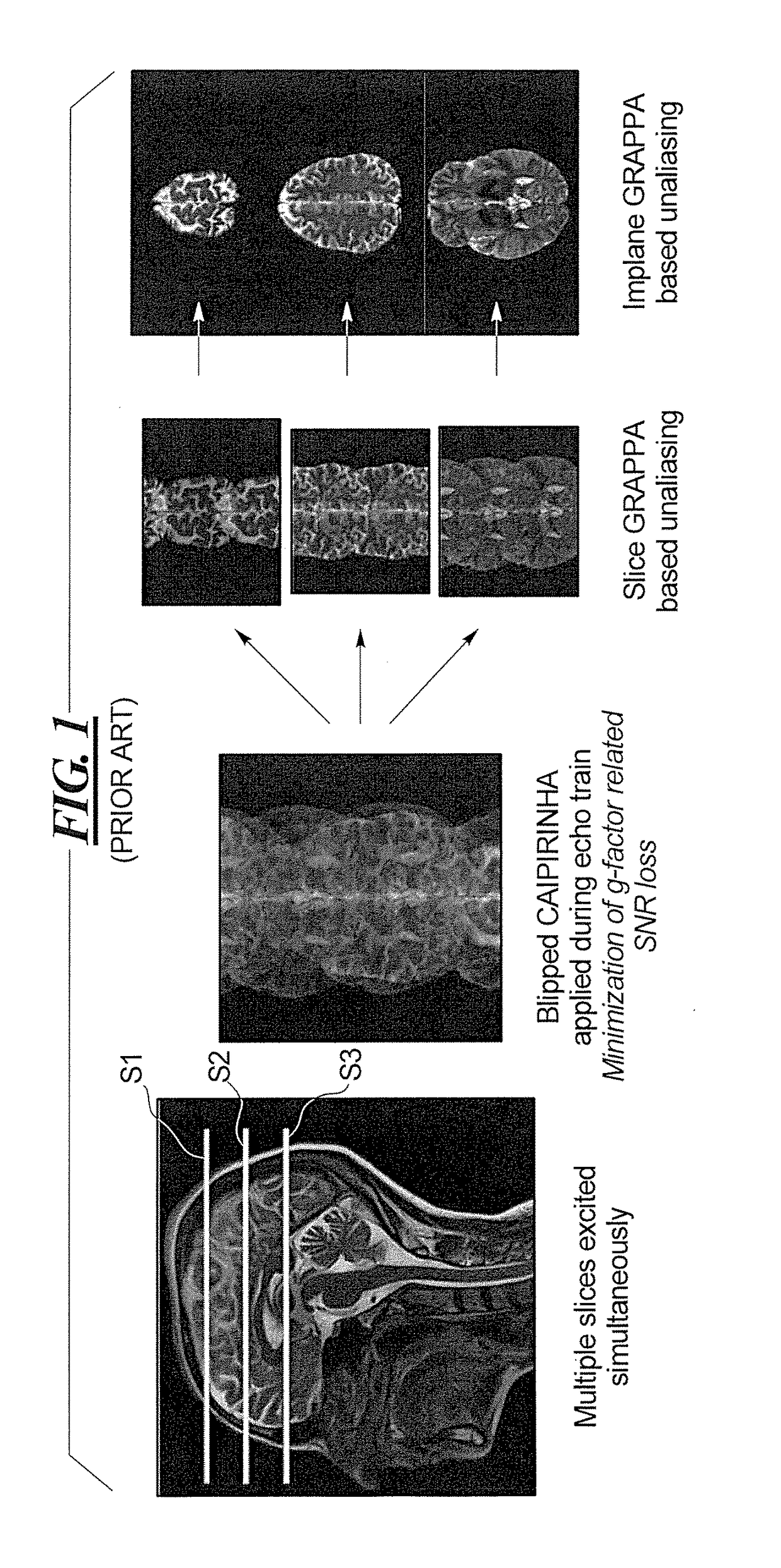 Method and magnetic resonance imaging apparatus for spatial fat suppression in multi-contrast SMS imaging