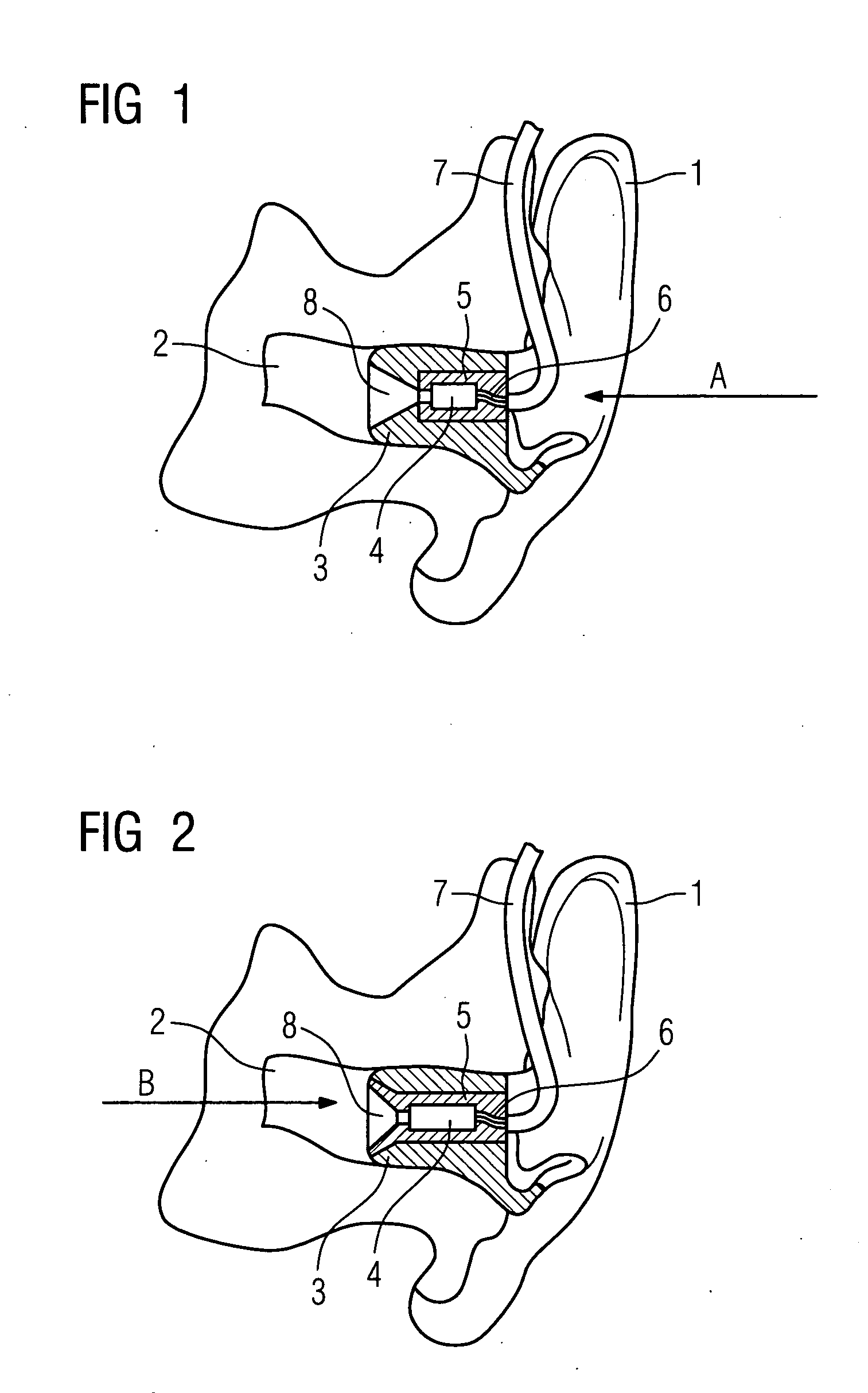 Ear insert for hearing aids