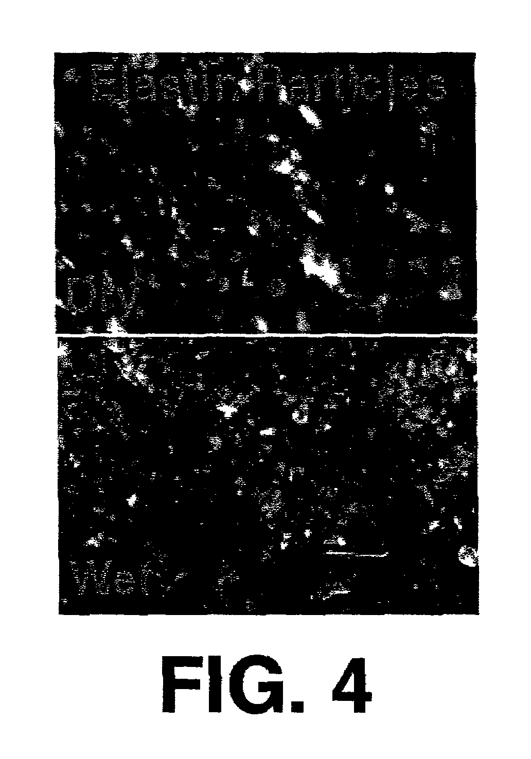Protein matrix materials, devices and methods of making and using thereof