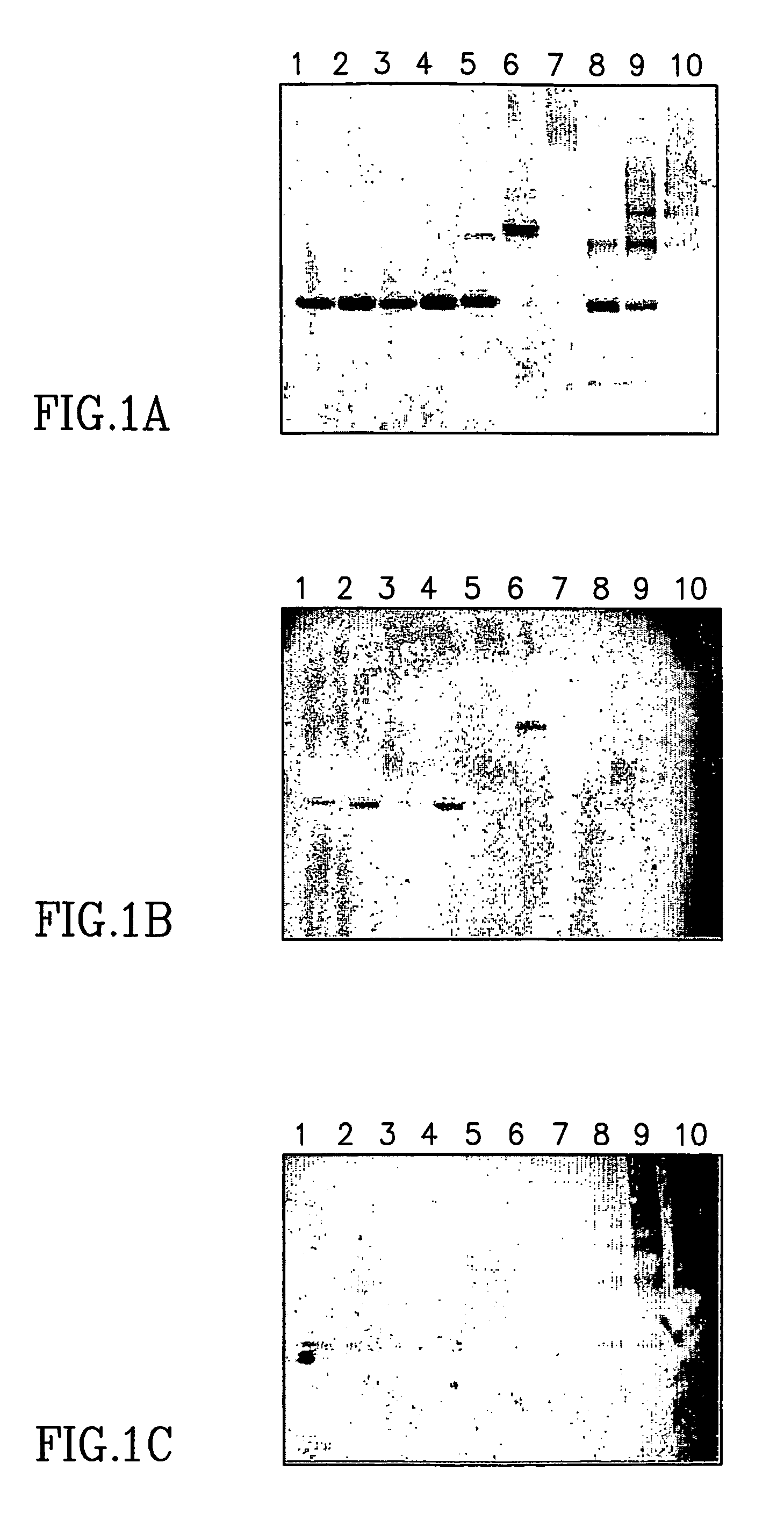 Large scale preparation of alpha-1 proteinase inhibitor and use thereof