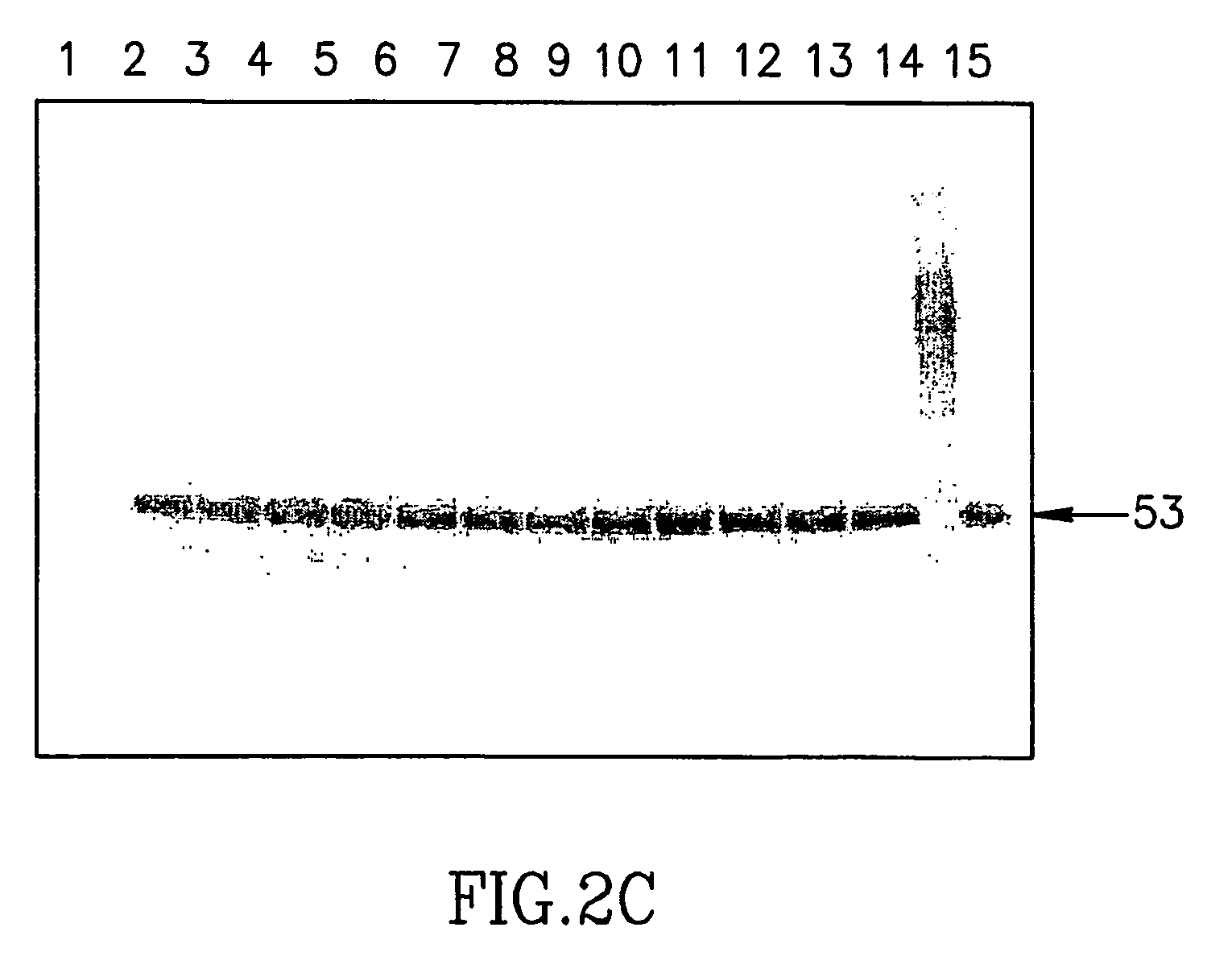 Large scale preparation of alpha-1 proteinase inhibitor and use thereof