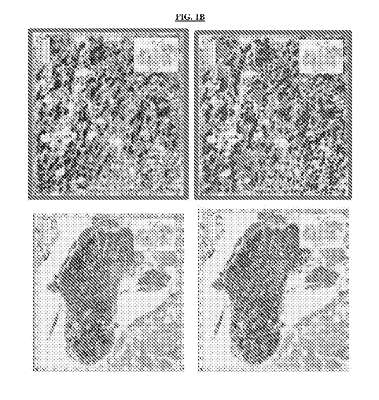 Compounds and compositions useful for treating or preventing cancer metastasis, and methods using same