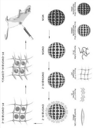 Preparation method and application of PEGylated MSNs nanoparticle and mesoporous silica modified sustained-release hydrogel composite material