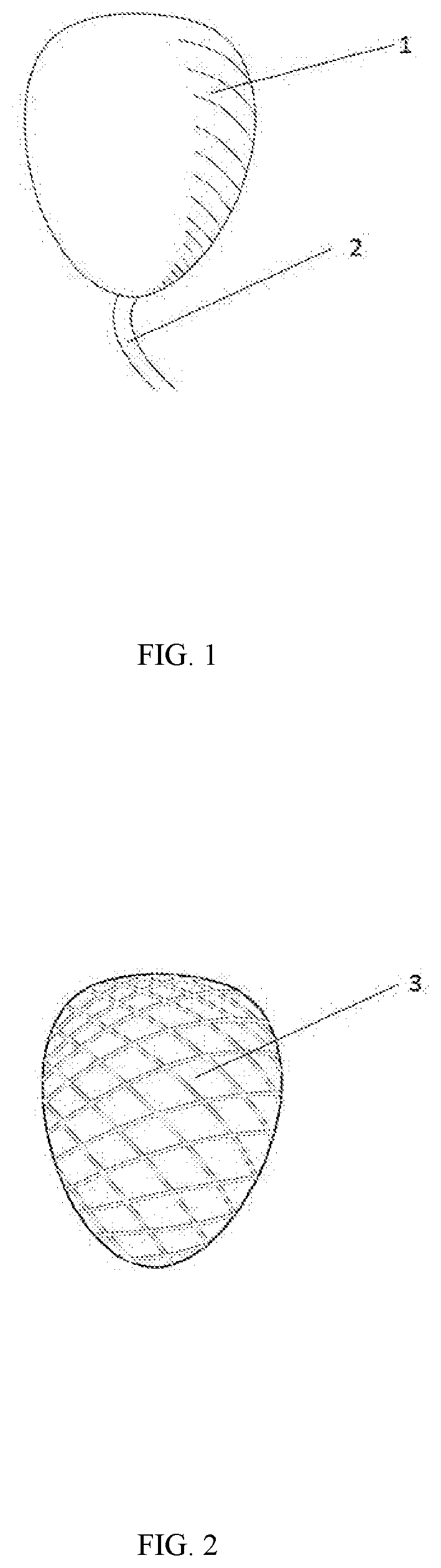 Implantable ventricular assist device