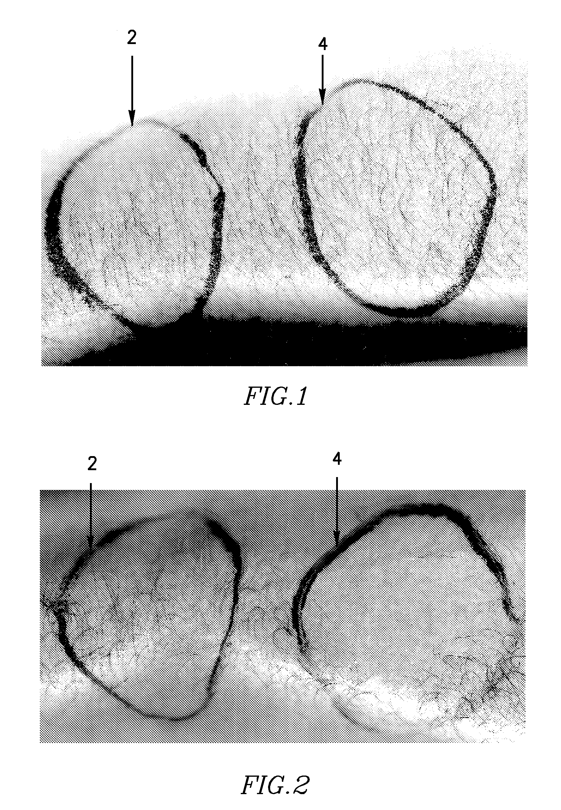 Apparatus and method for skin treatment