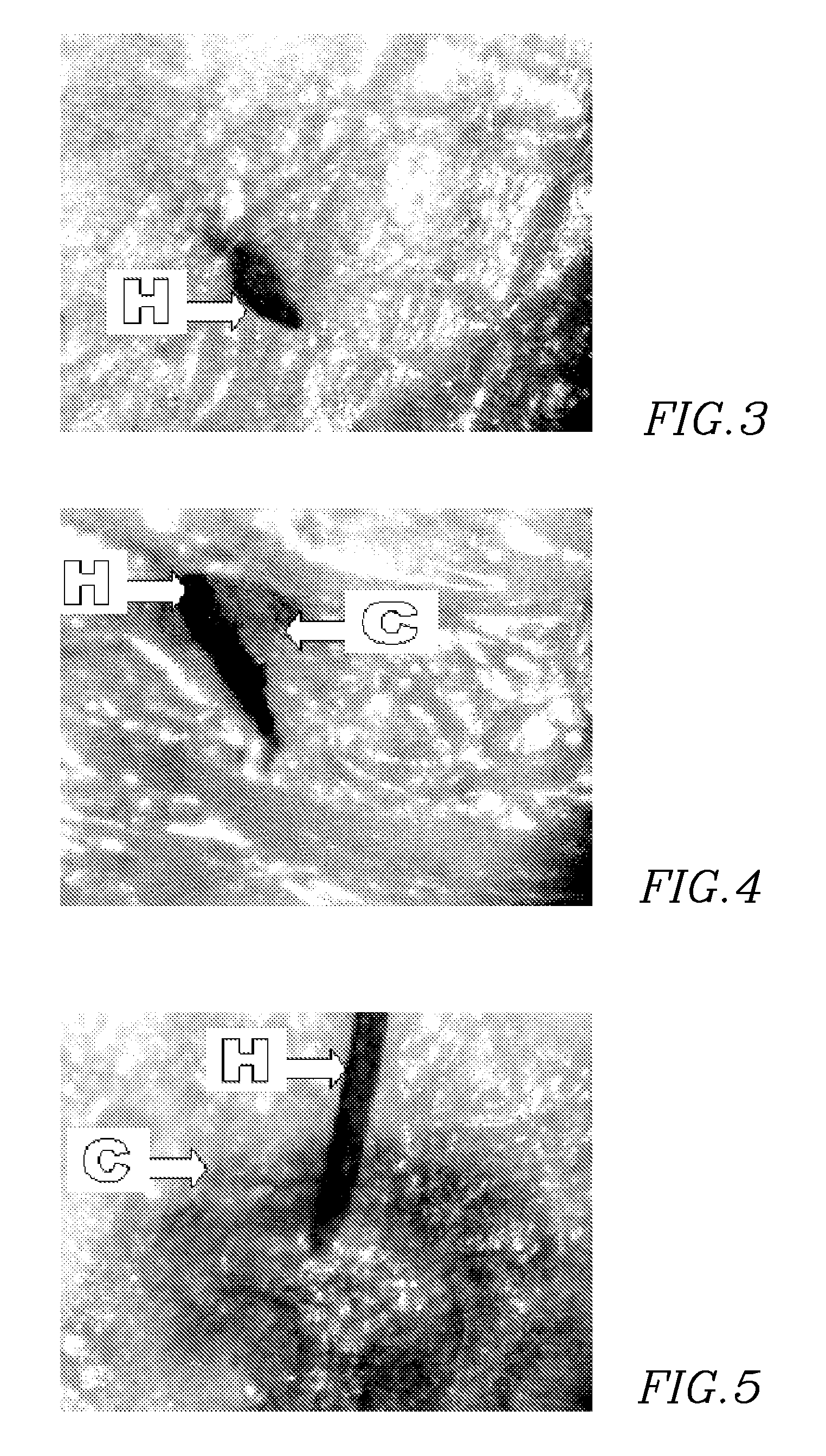 Apparatus and method for skin treatment