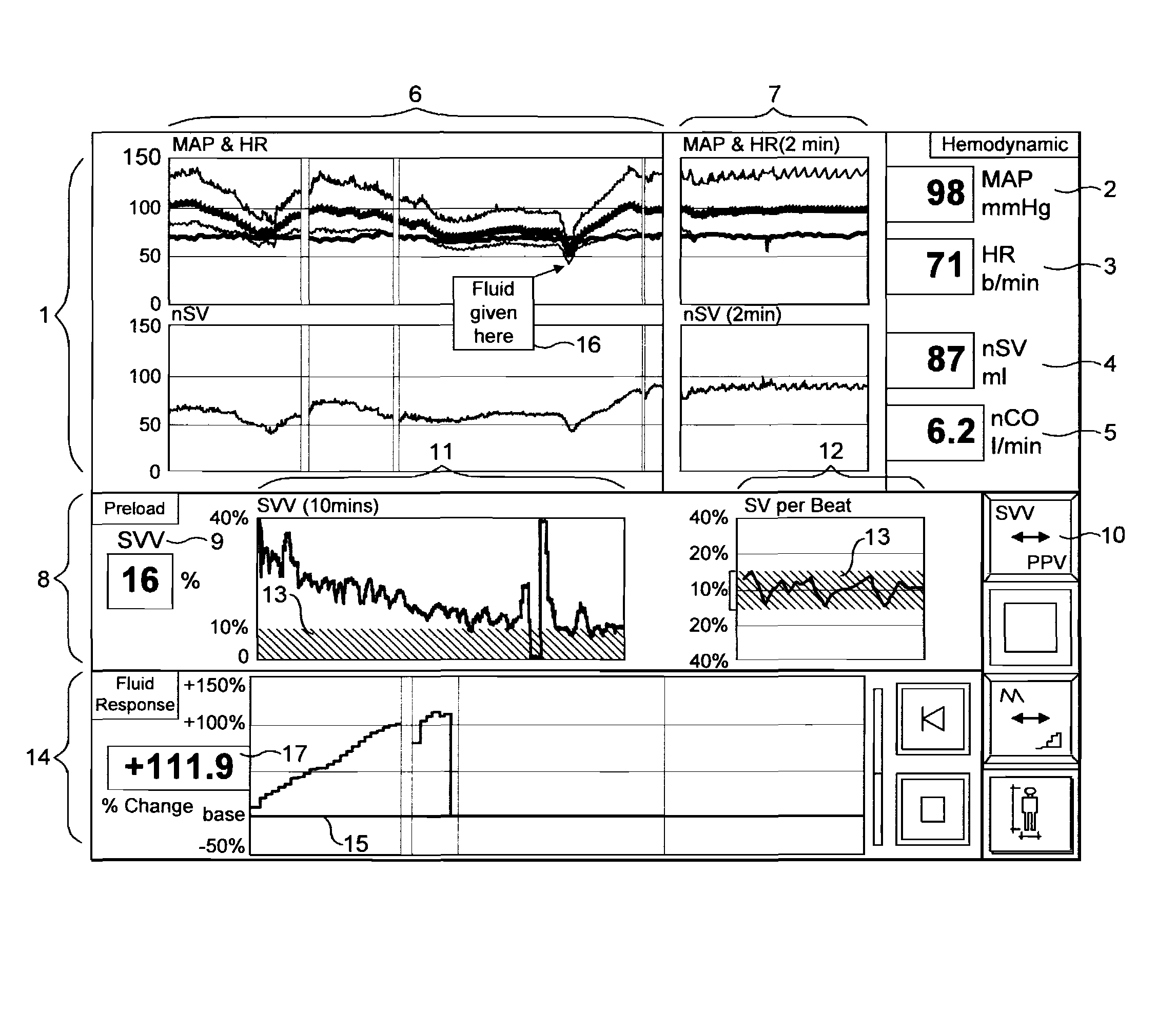 Patient monitoring