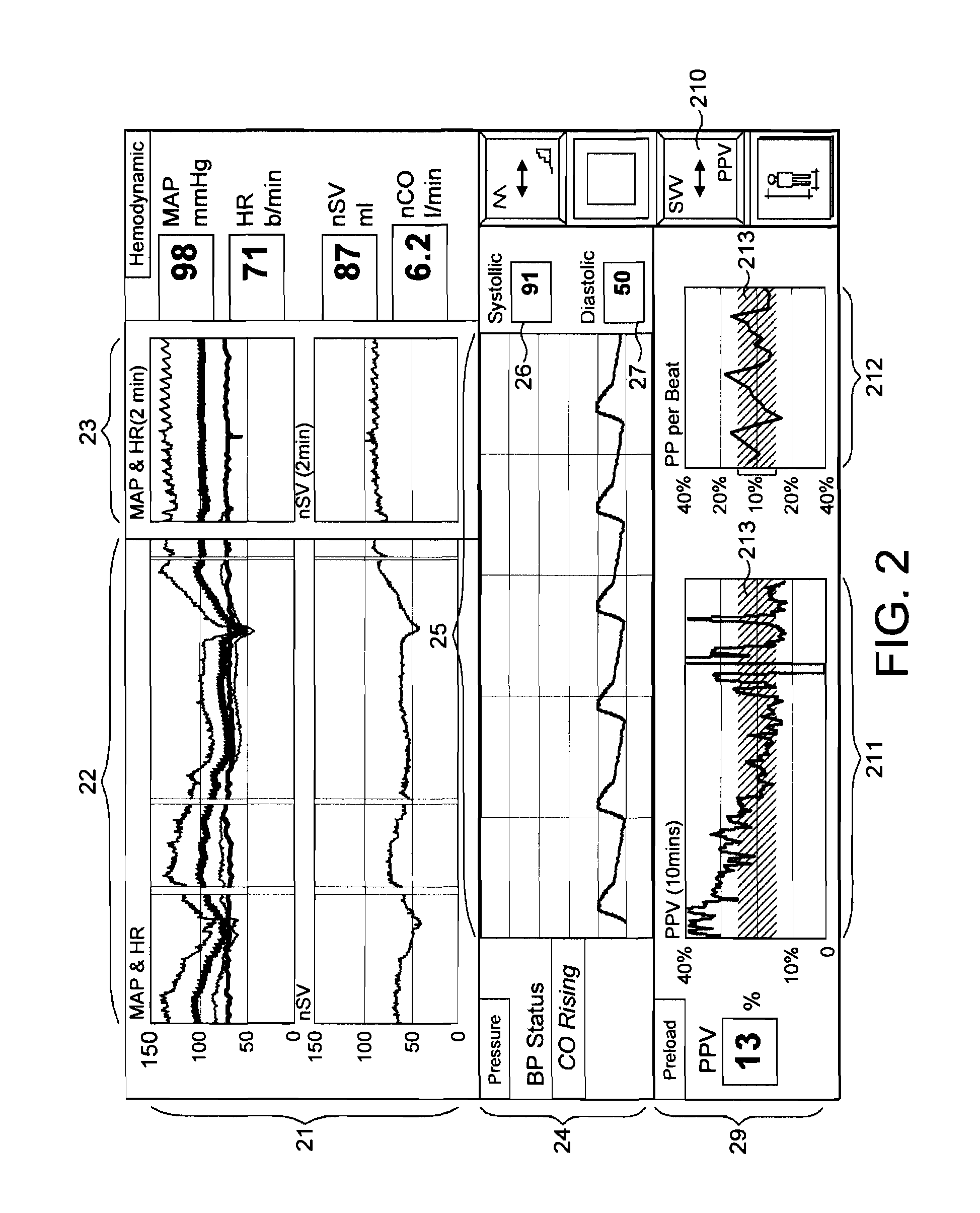 Patient monitoring