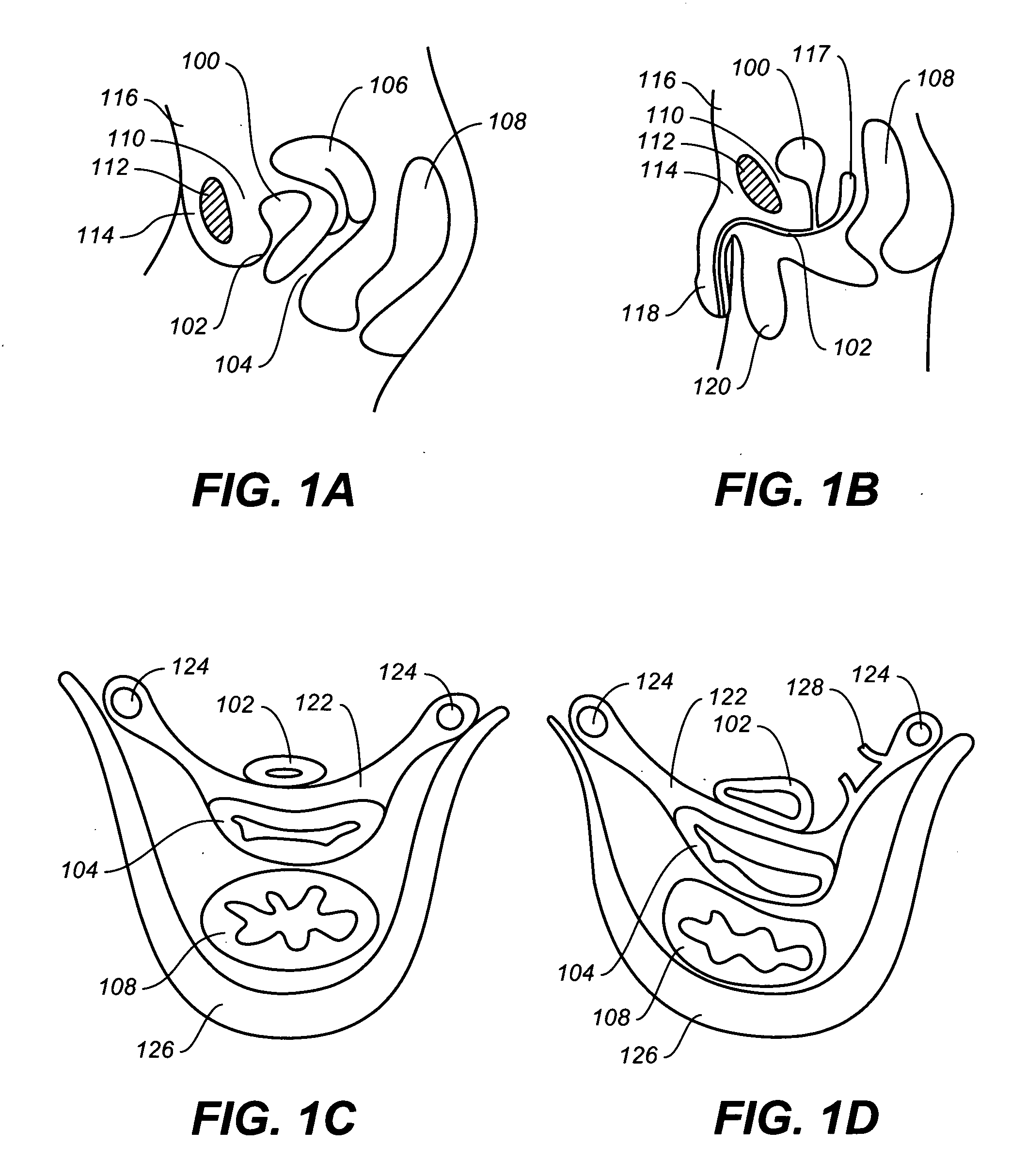 Dynamic and adjustable support devices