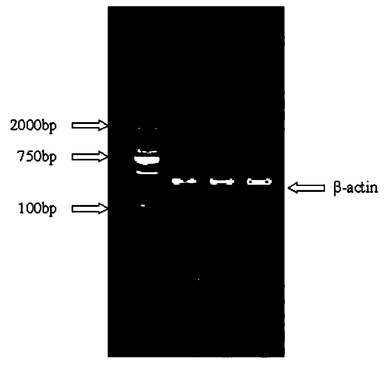 Method for extracting total ribonucleic acid (RNA) of fish brain tissue