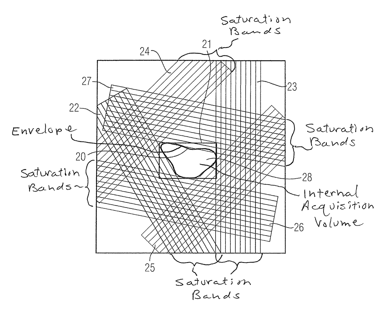 Method and magnetic resonance system for automated determination of an acquisition volume related to an examination region for the acquisition of a magnetic resonance data set