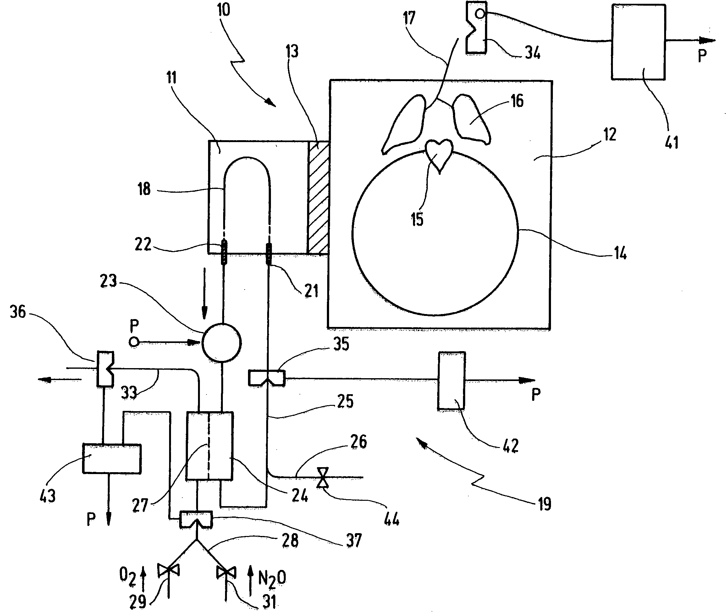 Device and method for establishing an artificial isolated circulation in a target area of a human or animal body