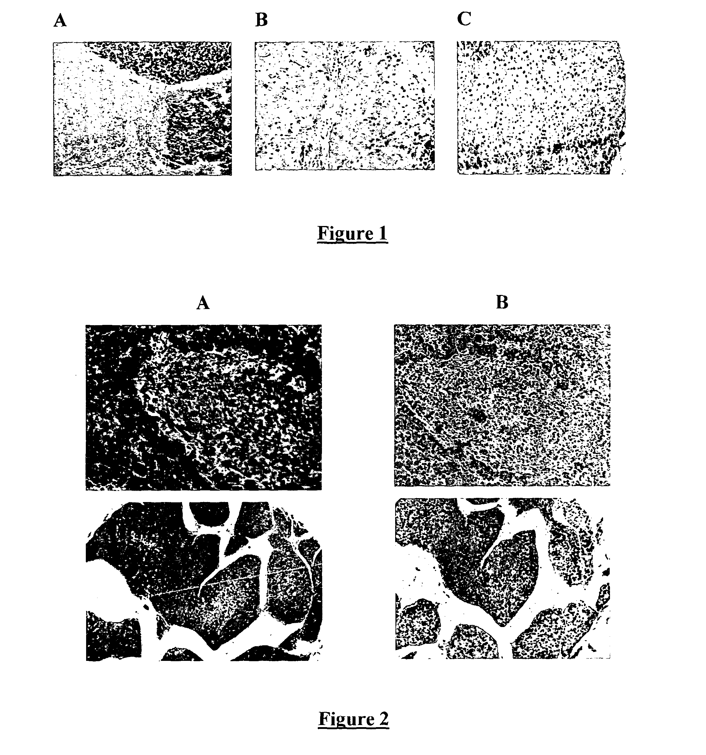 Treatment of liver cancer