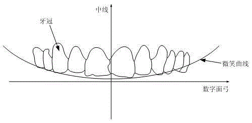 Digital designing method of dental crown veneer