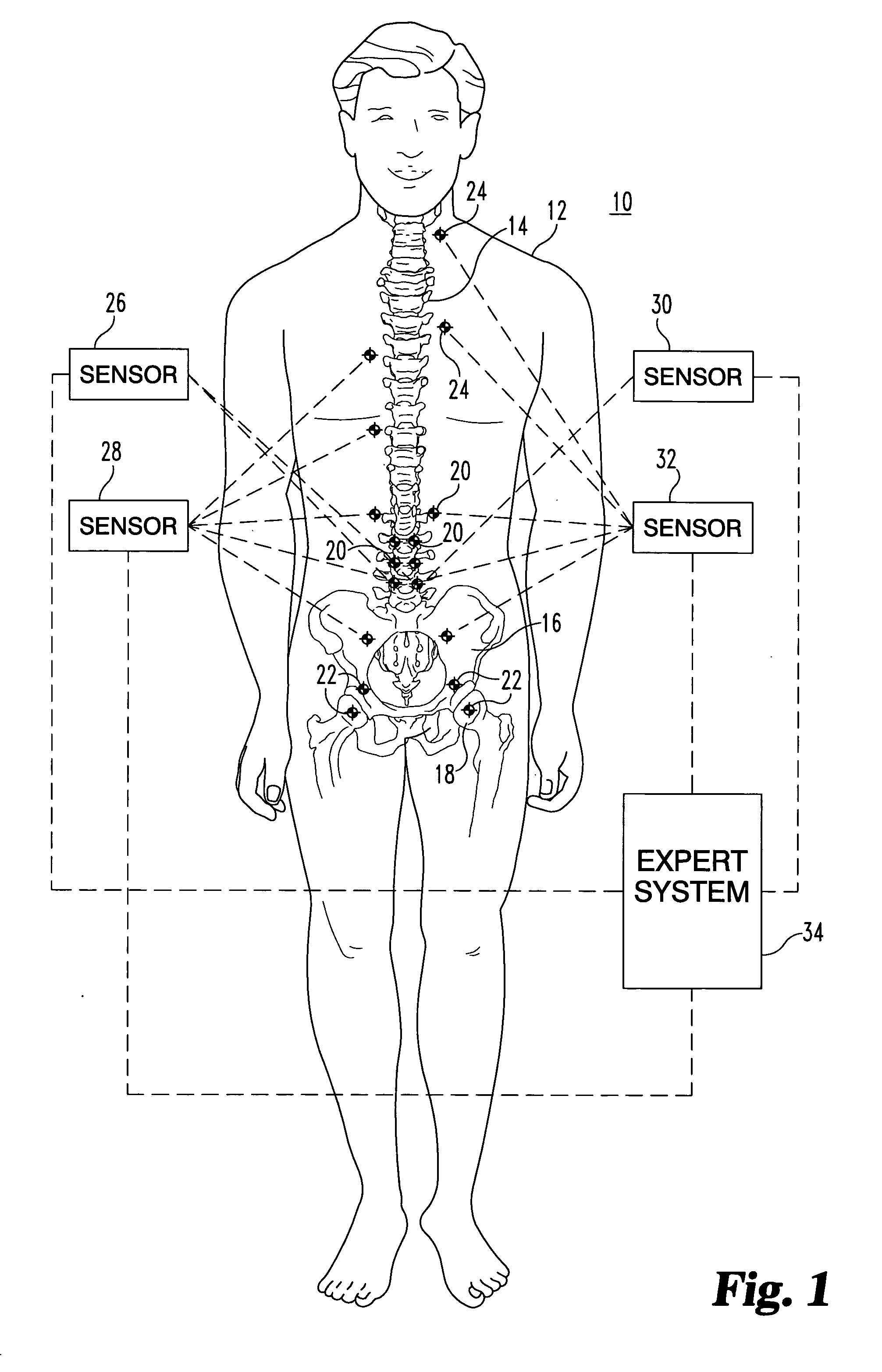 Method and apparatus for expert system to track and manipulate patients