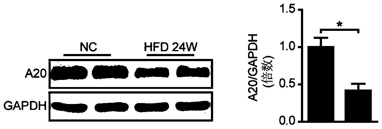 Application of Tumor Necrosis Factor α-Inducible Protein 3 in the Preparation of Drugs for Treating Diabetic Cardiomyopathy