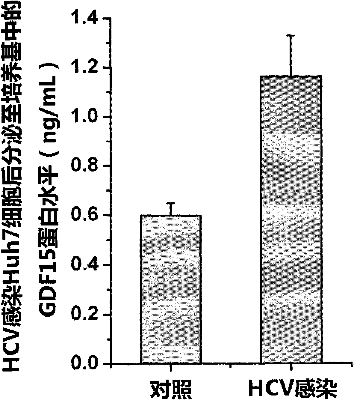 New applications of antibody of GDF15 (Growth differentiation factor 15) protein