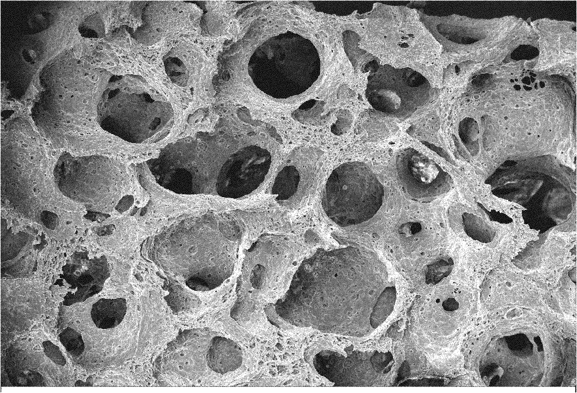 Medicinal microporous sponge and preparation method thereof