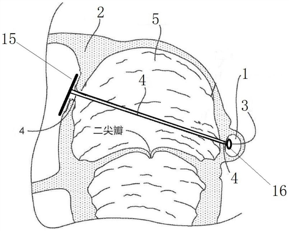 Mitral valve repair device with protection structure
